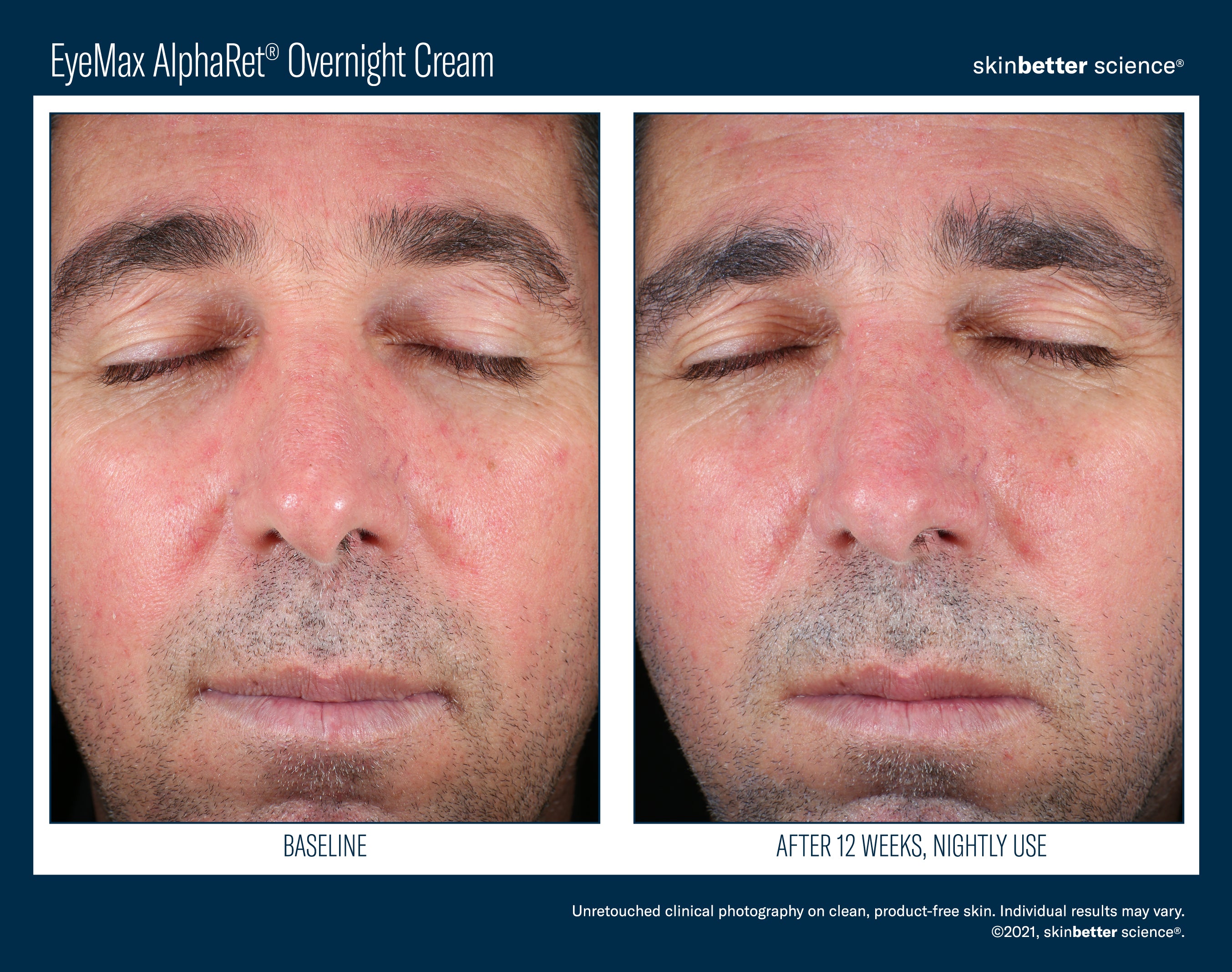 SkinBetter Science EyeMax AlphaRet Overnight Cream (0.5 oz)