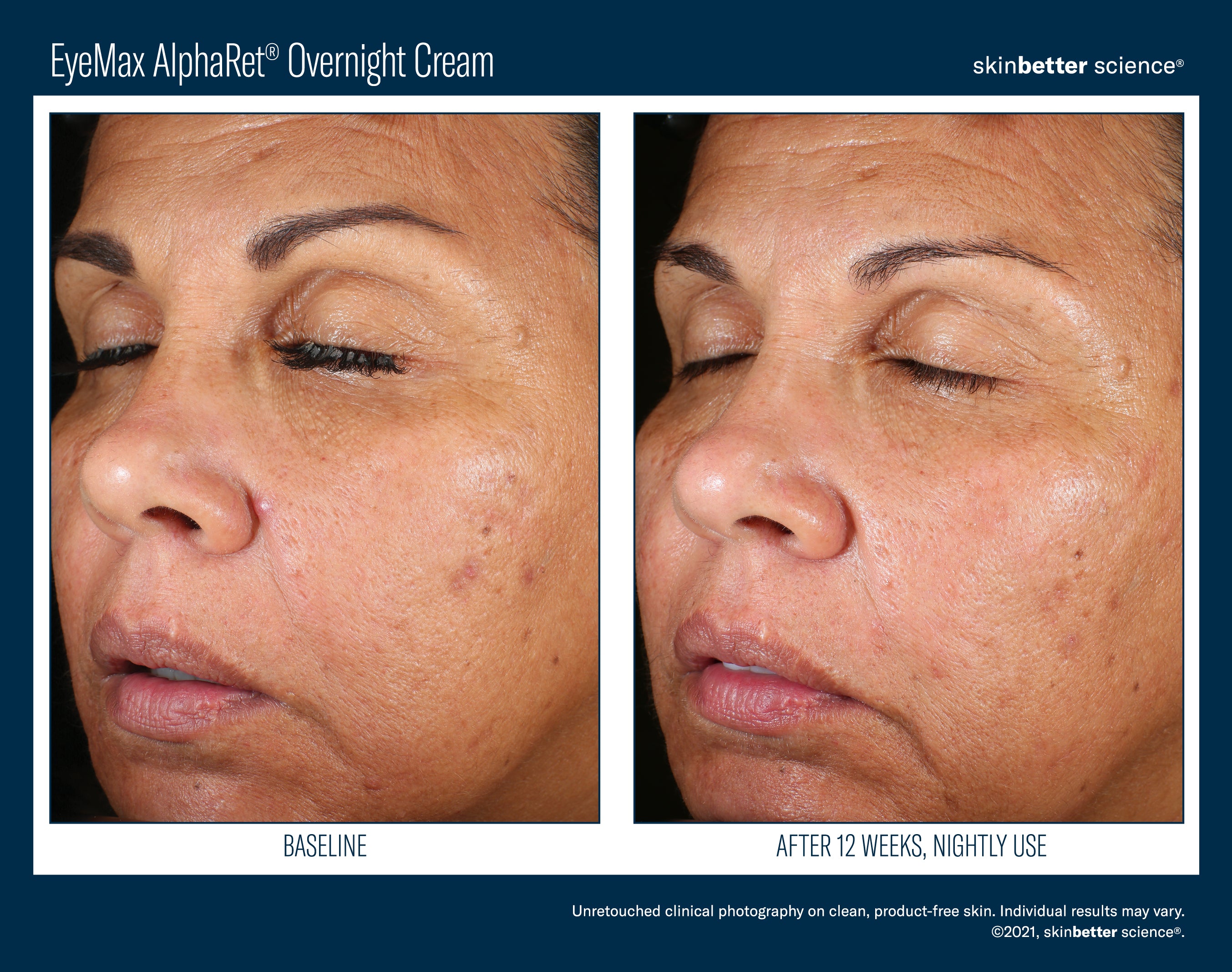 SkinBetter Science EyeMax AlphaRet Overnight Cream (0.5 oz)