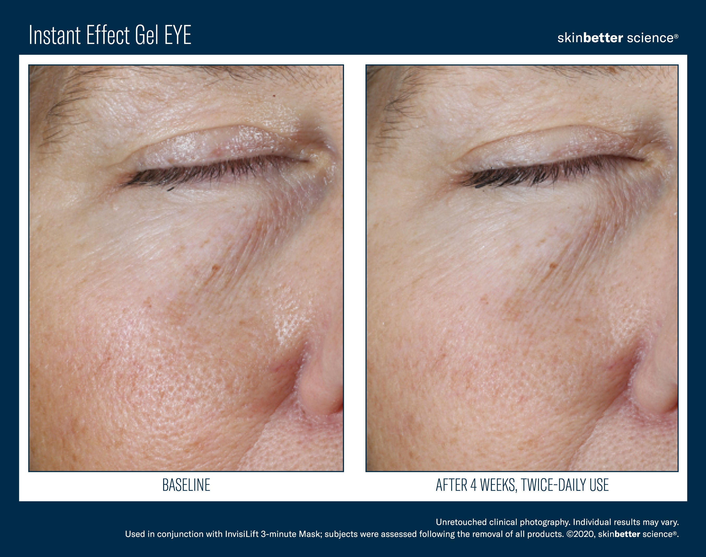 SkinBetter Science Instant Effect Gel Eye (0.5 oz)