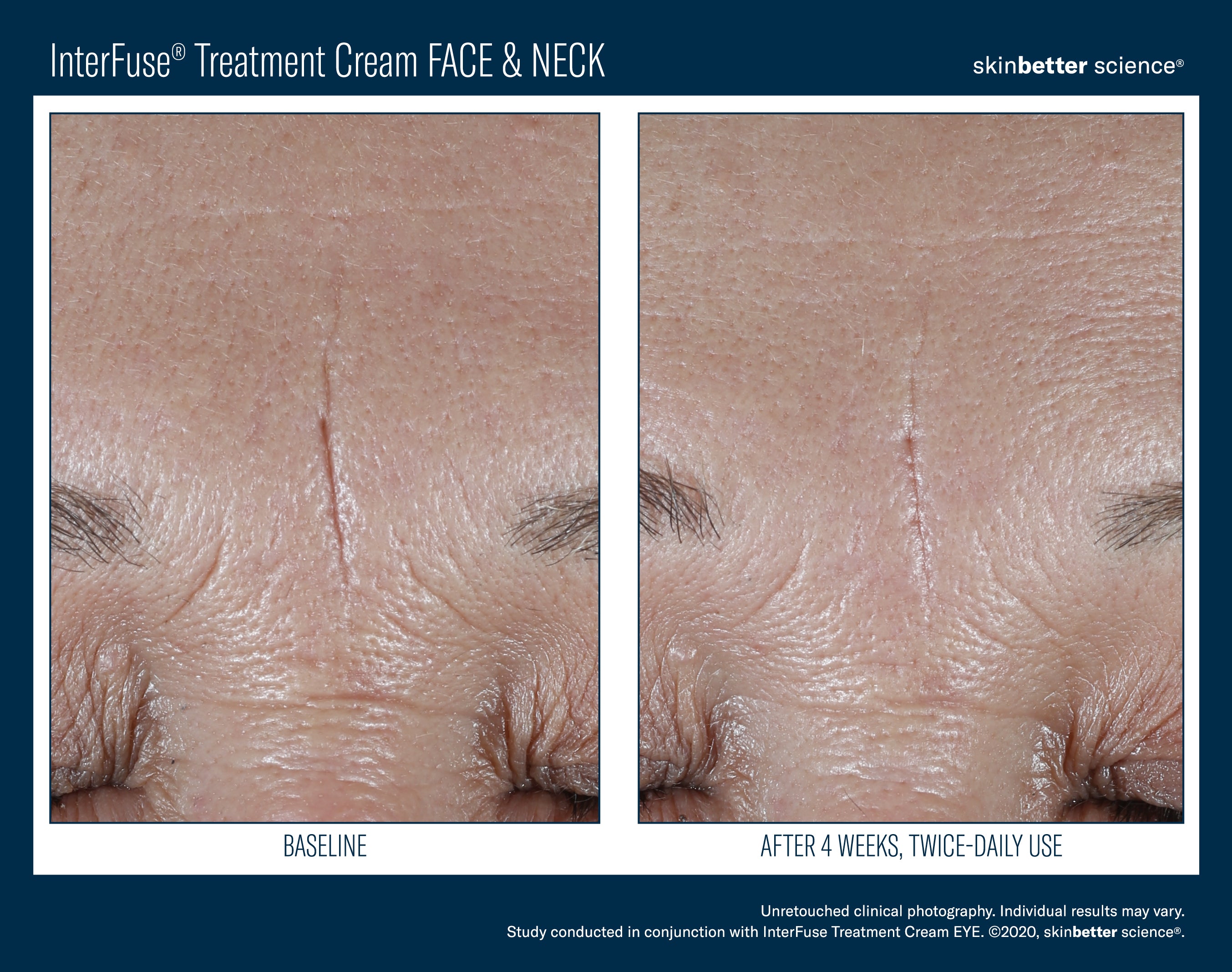 SkinBetter Science InterFuse Treatment Cream Face & Neck (1 oz)