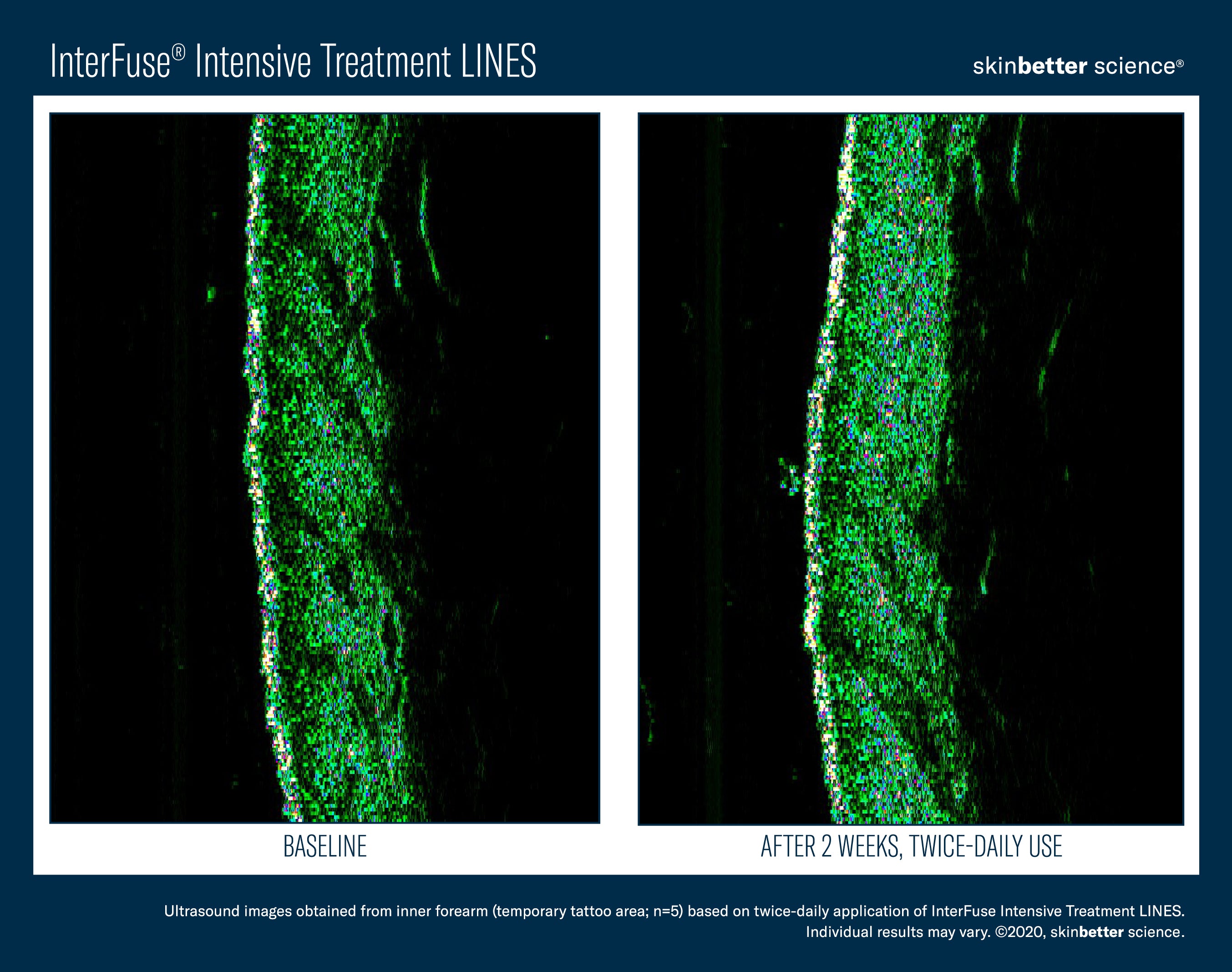 SkinBetter Science InterFuse Intensive Treatment Lines (1 oz)