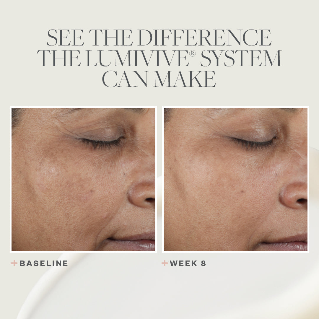 SkinMedica LUMIVIVE System