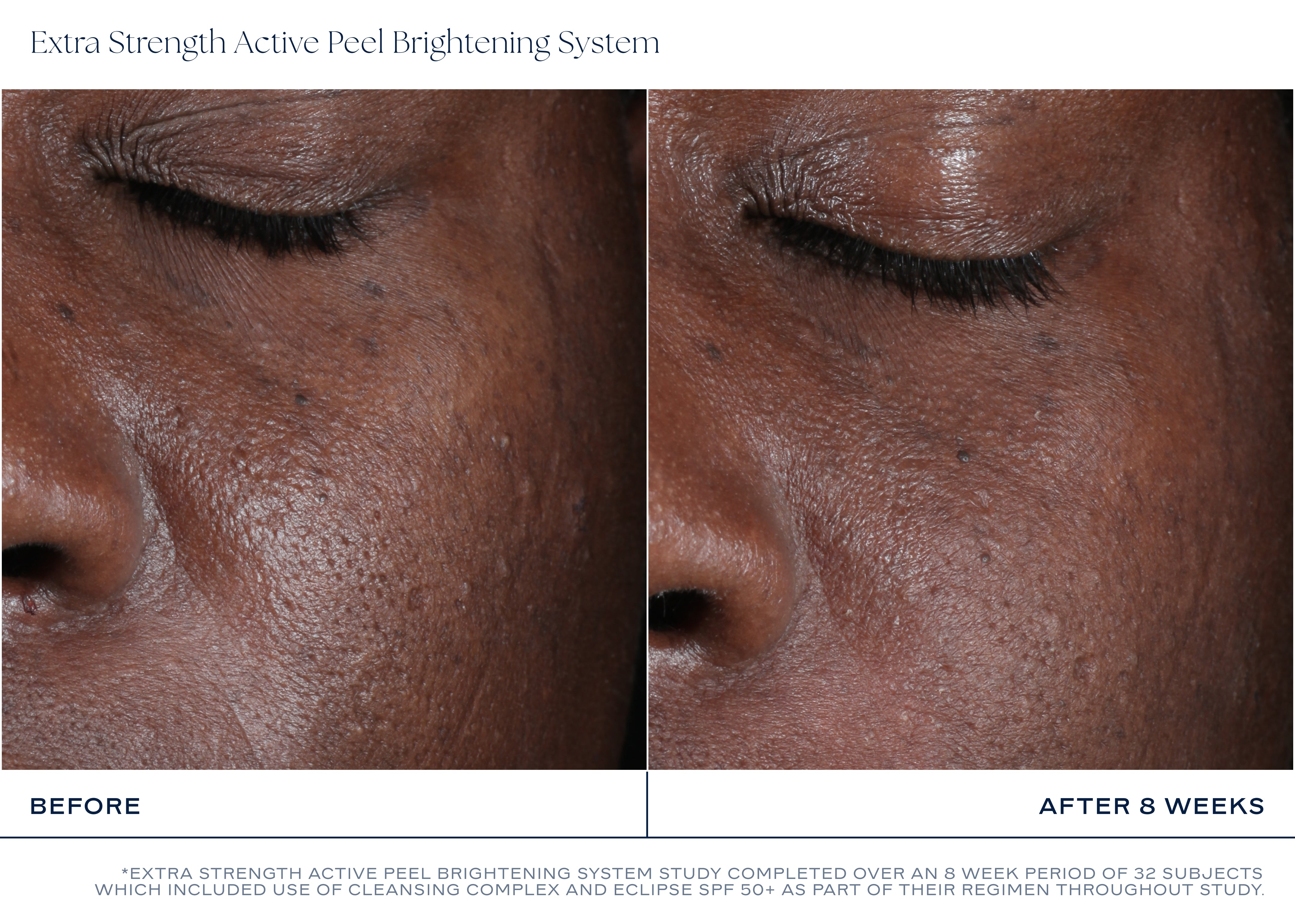 iS Clinical Extra Strength Active Peel Brightening System