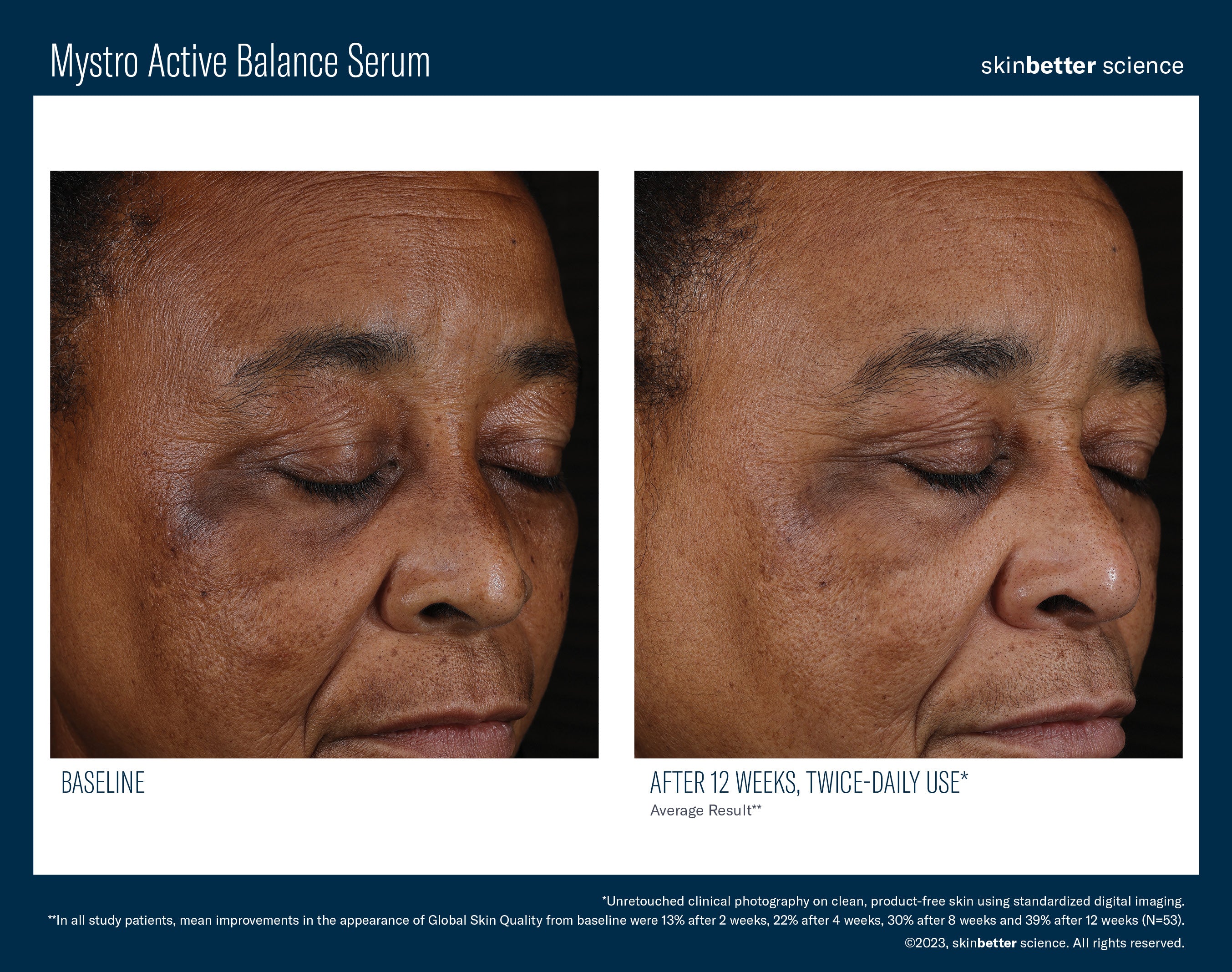 SkinBetter Science Mystro Active Balance Serum (0.5 oz)