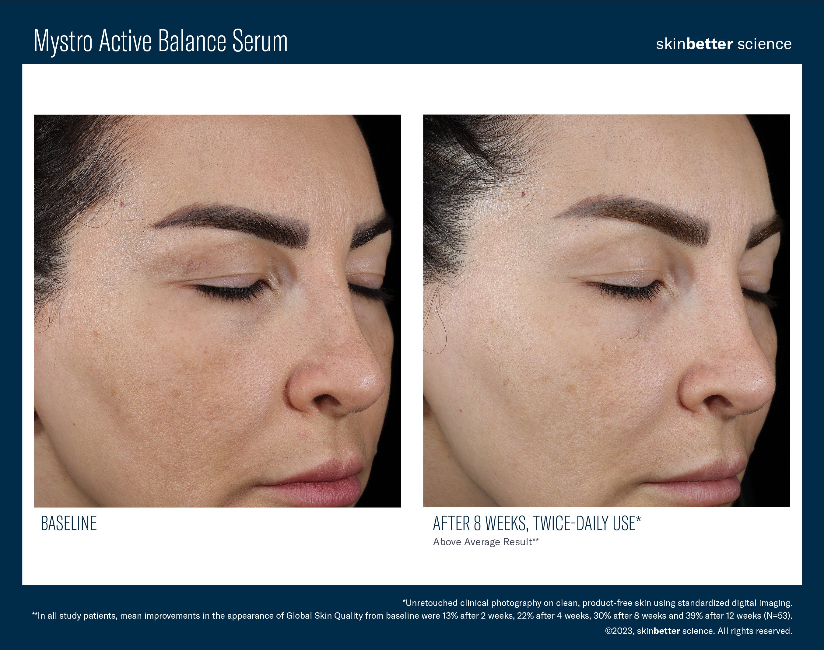 SkinBetter Science Mystro Active Balance Serum (0.5 oz)