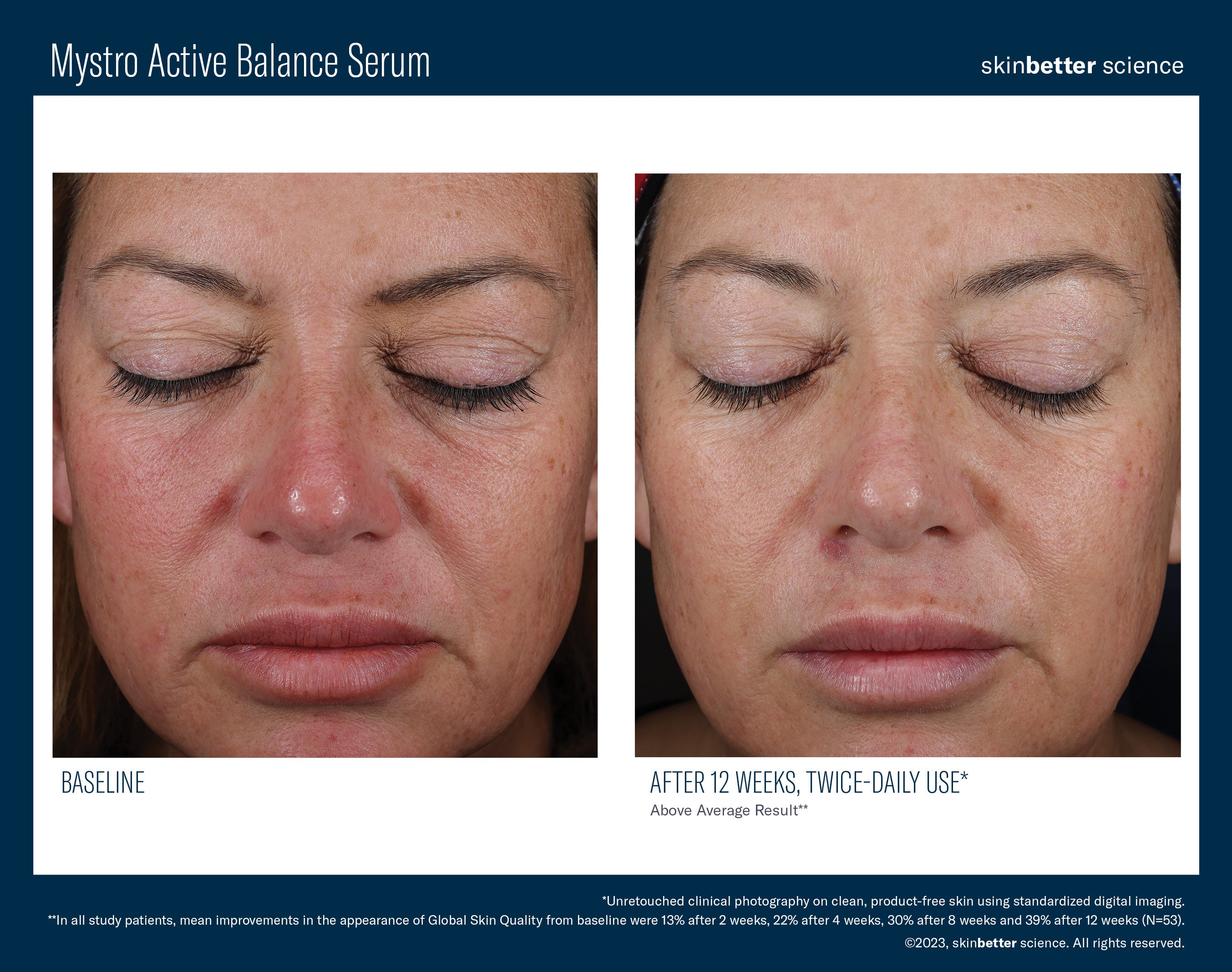 SkinBetter Science Mystro Active Balance Serum (1 oz)