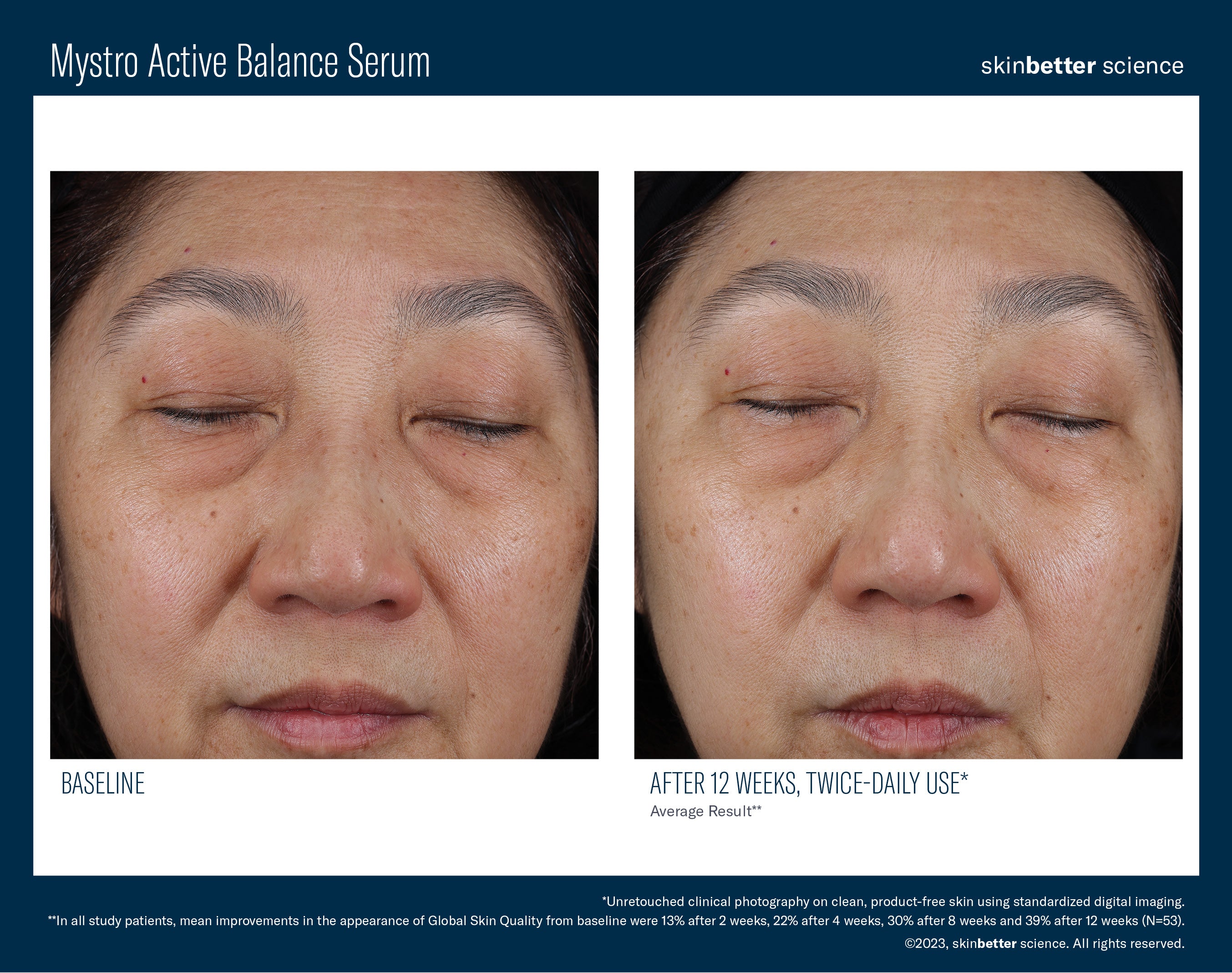 SkinBetter Science Mystro Active Balance Serum (1 oz)