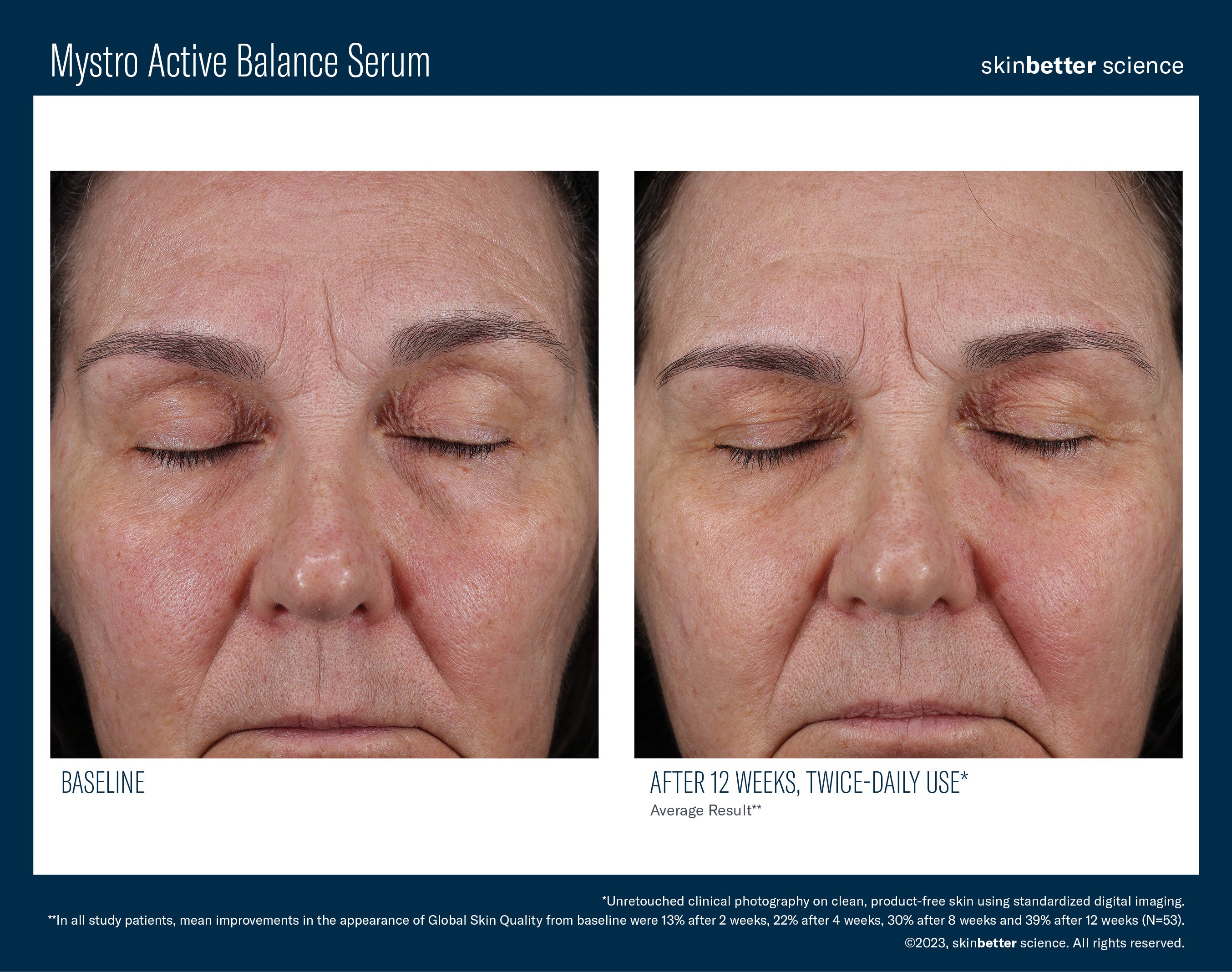 SkinBetter Science Mystro Active Balance Serum (0.5 oz)