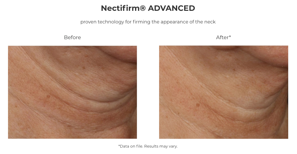 Revision Skincare Nectifirm® ADVANCED (1.7 oz)