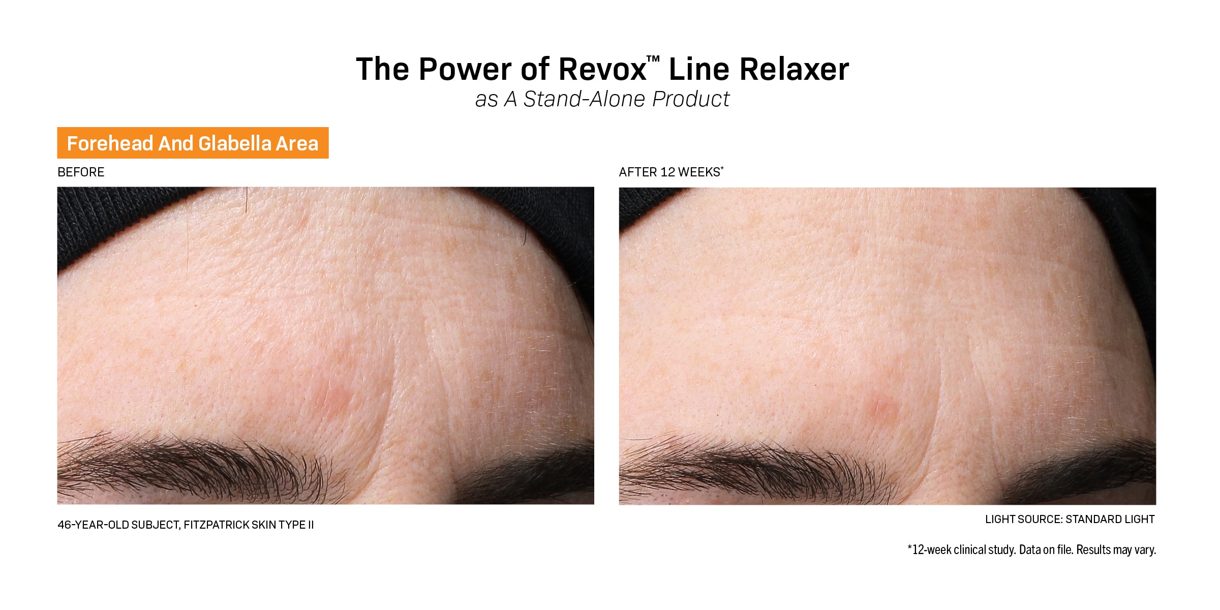 Revision Skincare Revox™ Line Relaxer (1 oz)