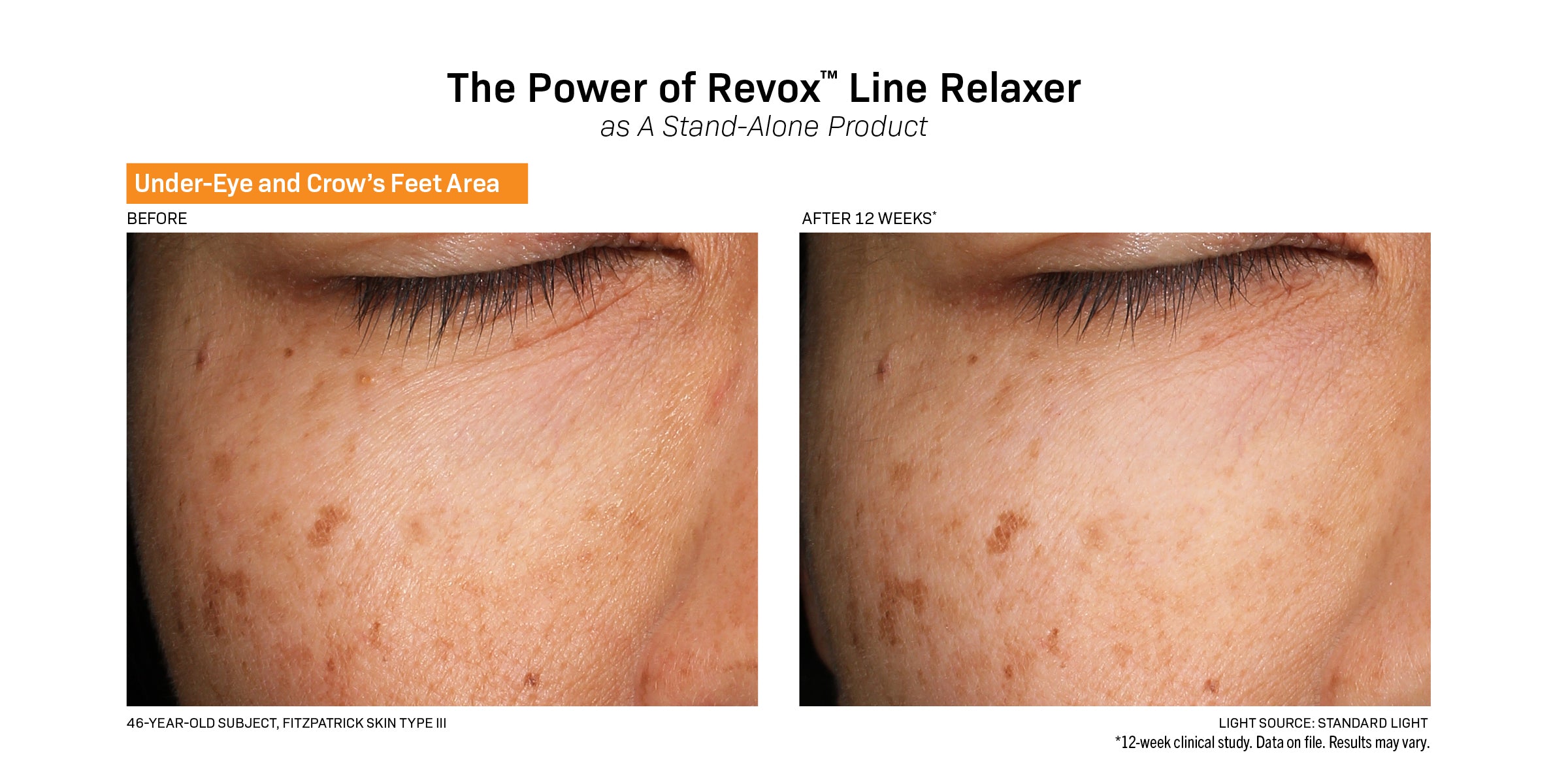 Revision Skincare Revox™ Line Relaxer (1 oz)