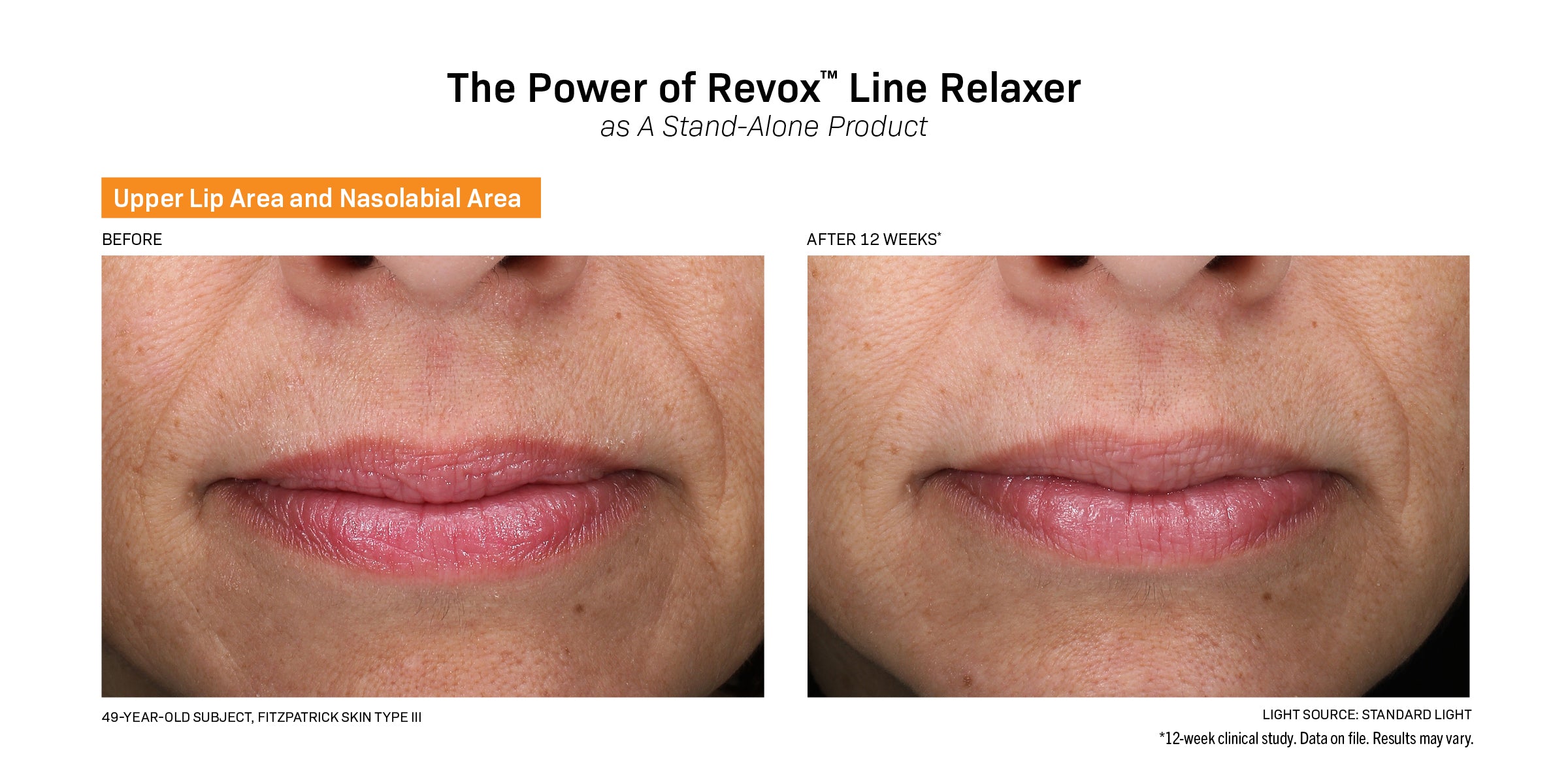 Revision Skincare Revox™ Line Relajante (1 oz)