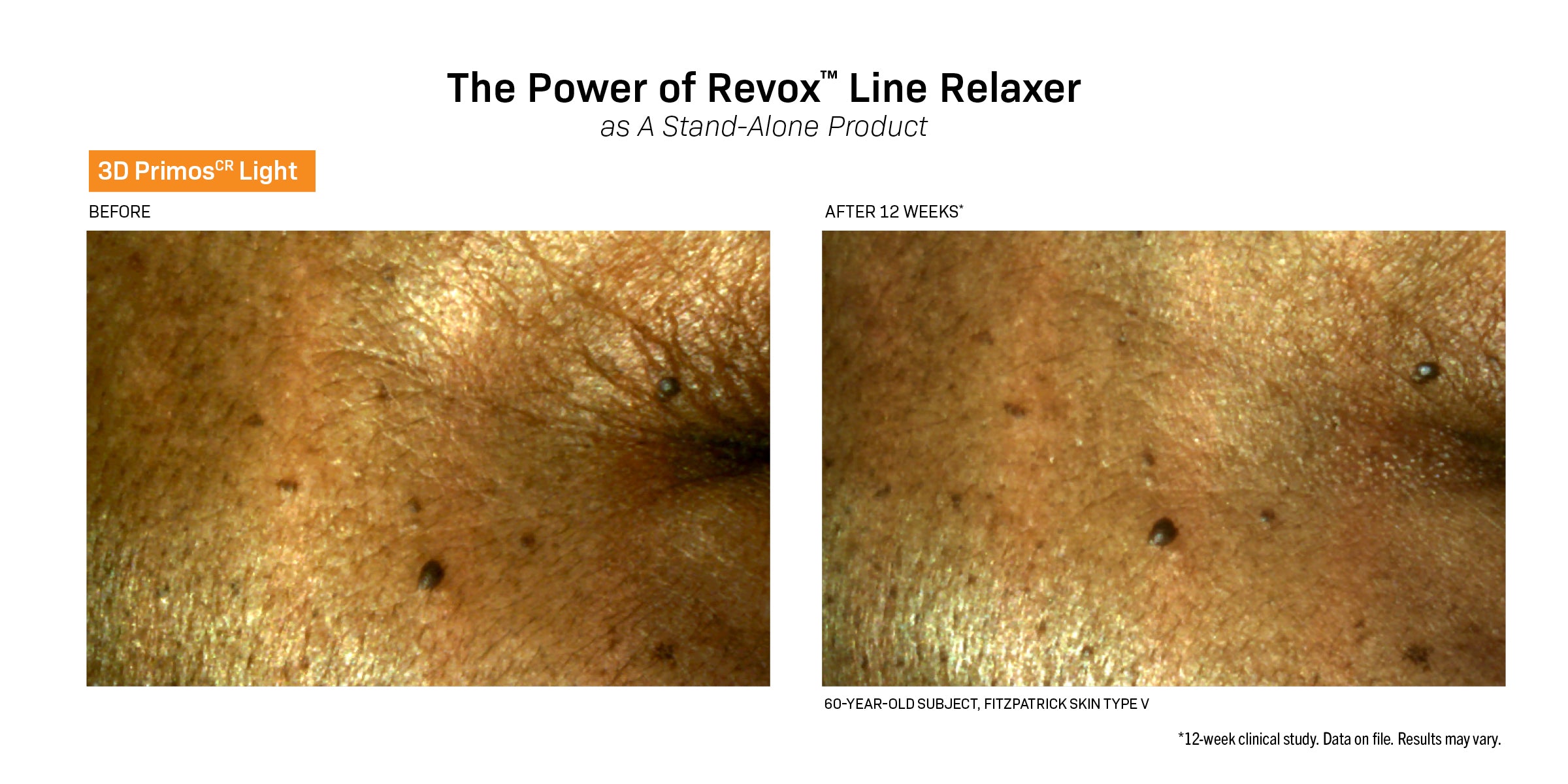 Revision Skincare Revox™ Line Relaser (1 አውንስ)