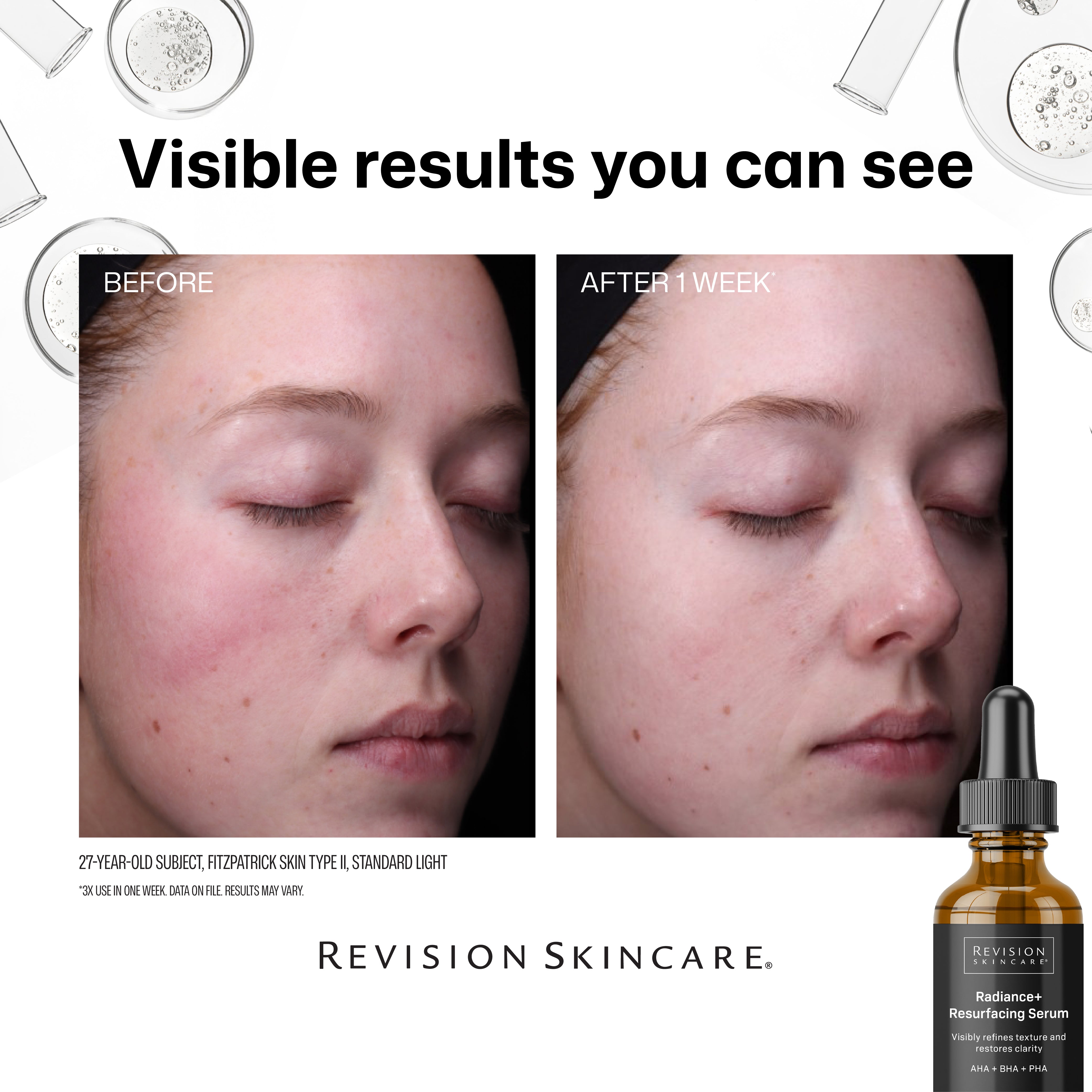Revision Skincare Radiance+ Resurfacing Serum (1 oz)