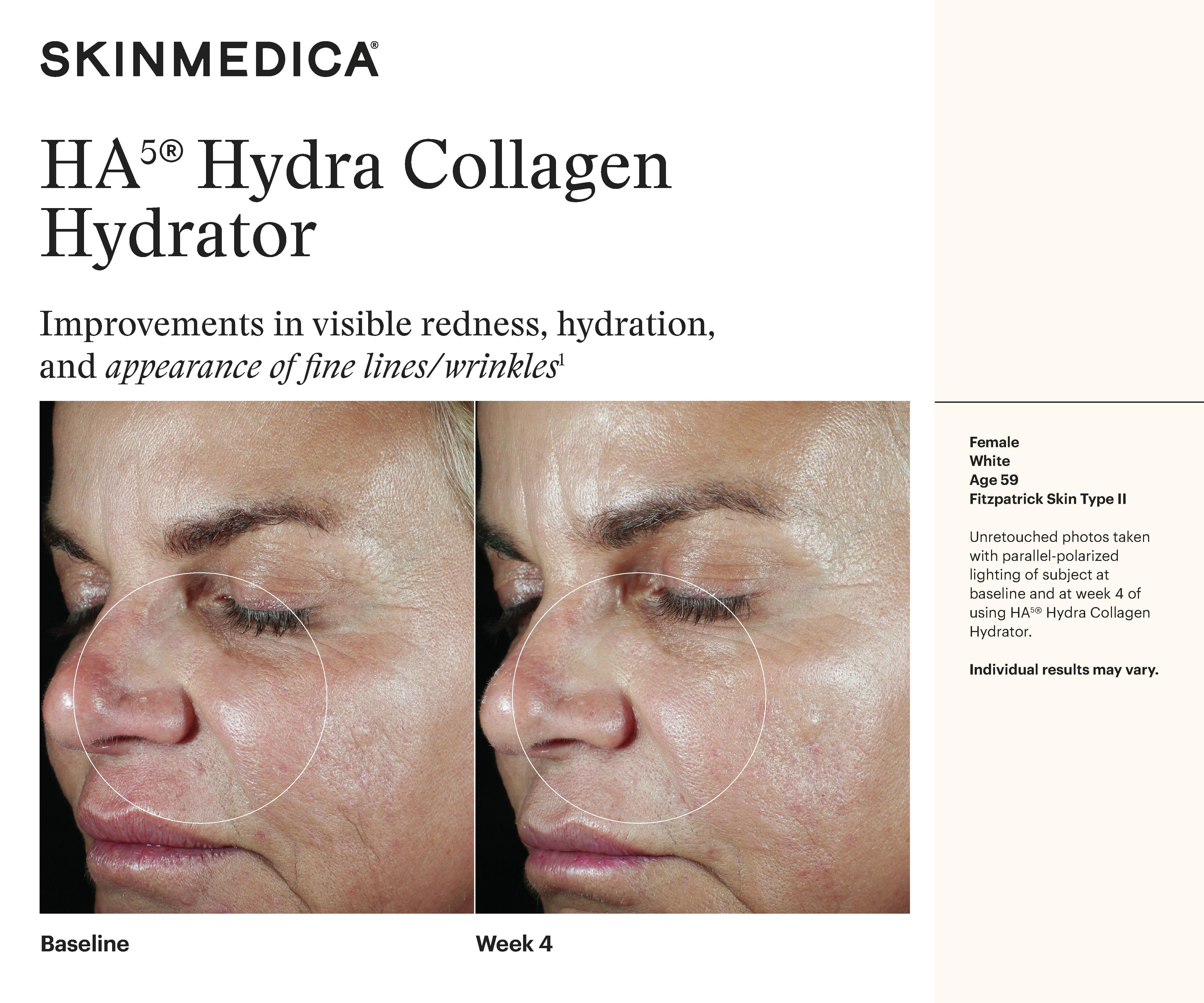 SkinMedica HA5 Hydra Collagen Replenish + Restore Hydrator (1.7 oz)