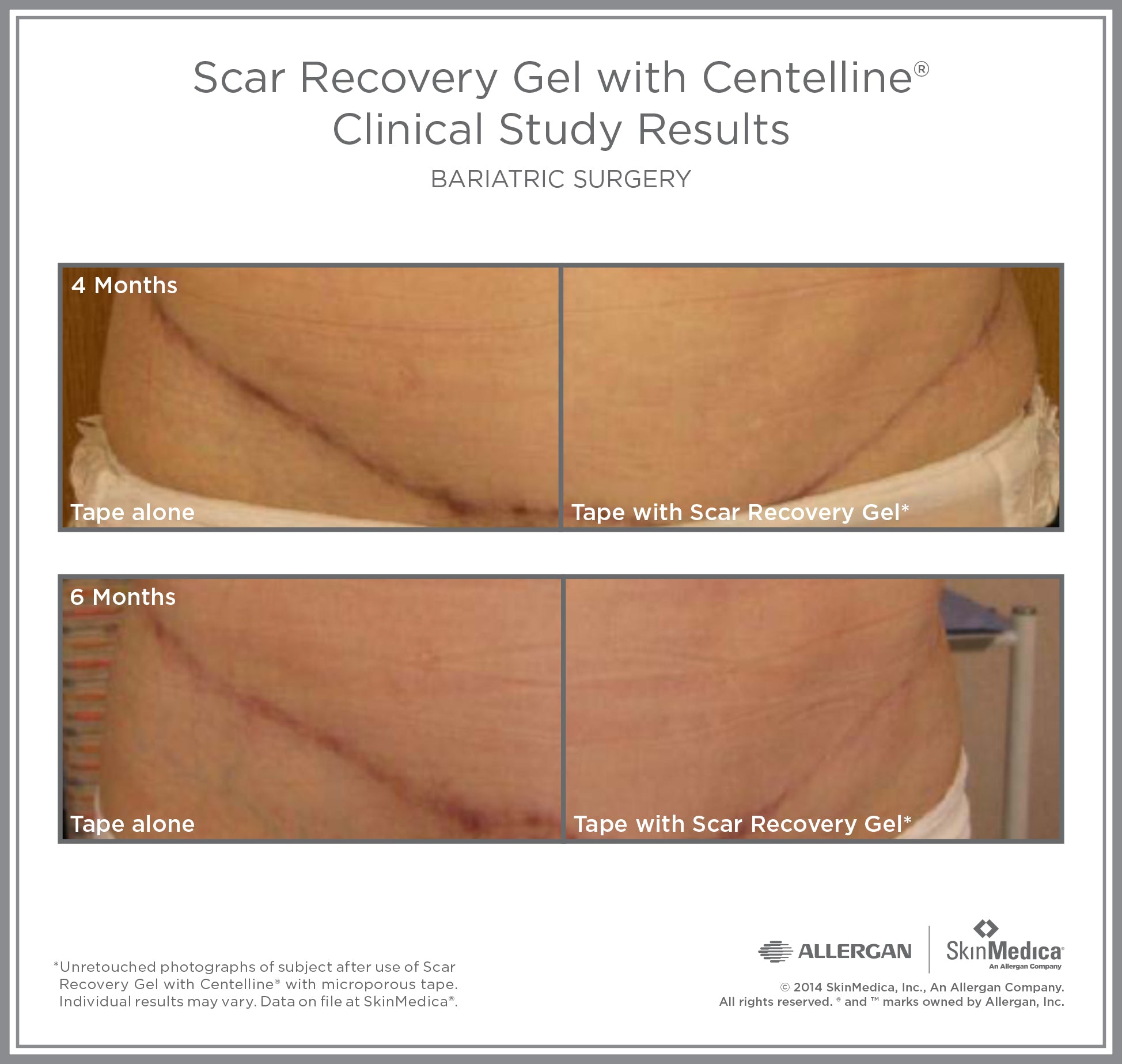 SkinMedica Scar Recovery Gel සමග Centelline (2 oz)