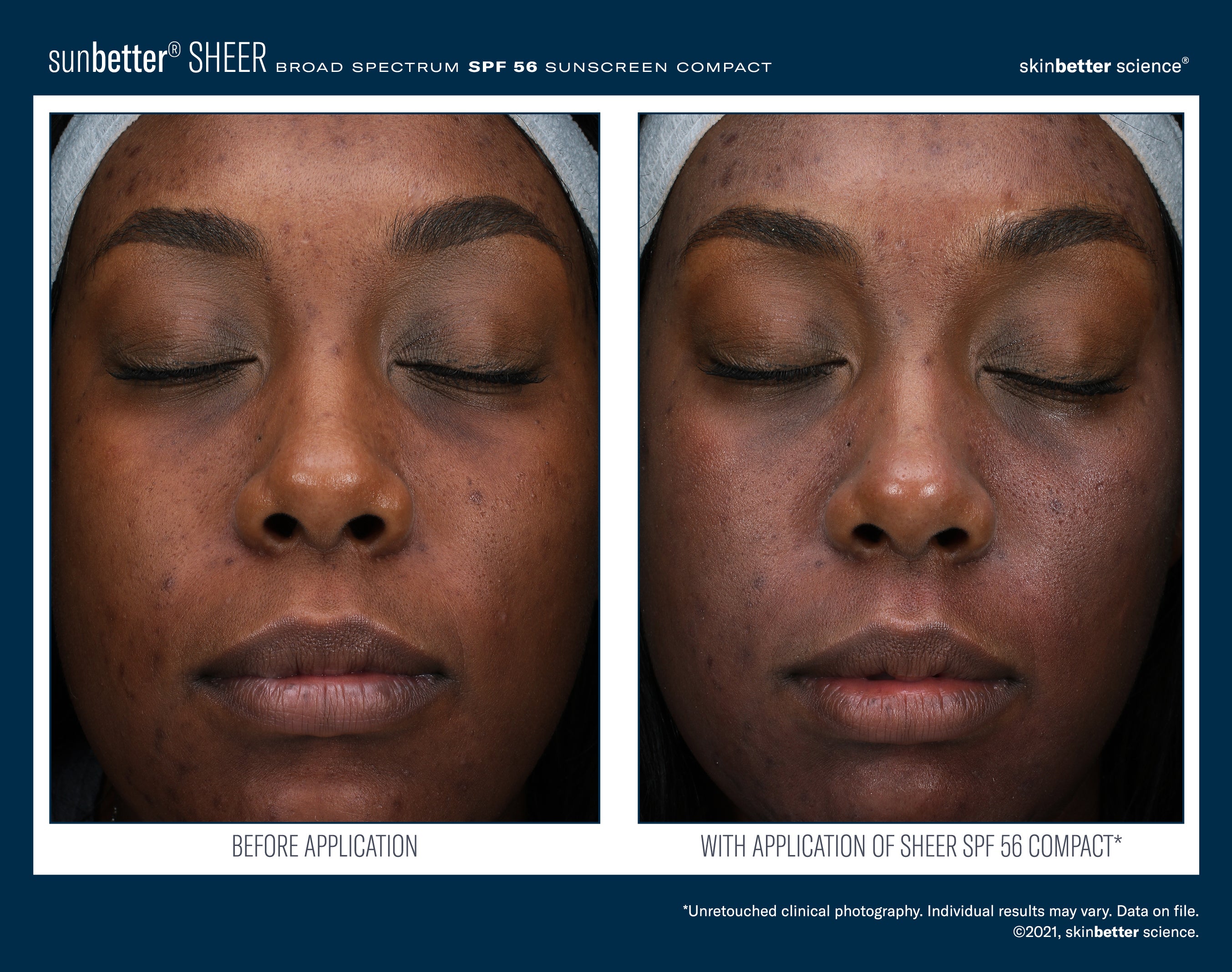 SkinBetter Science SunBetter SHEER SPF 56 Sunscreen Compact 12g