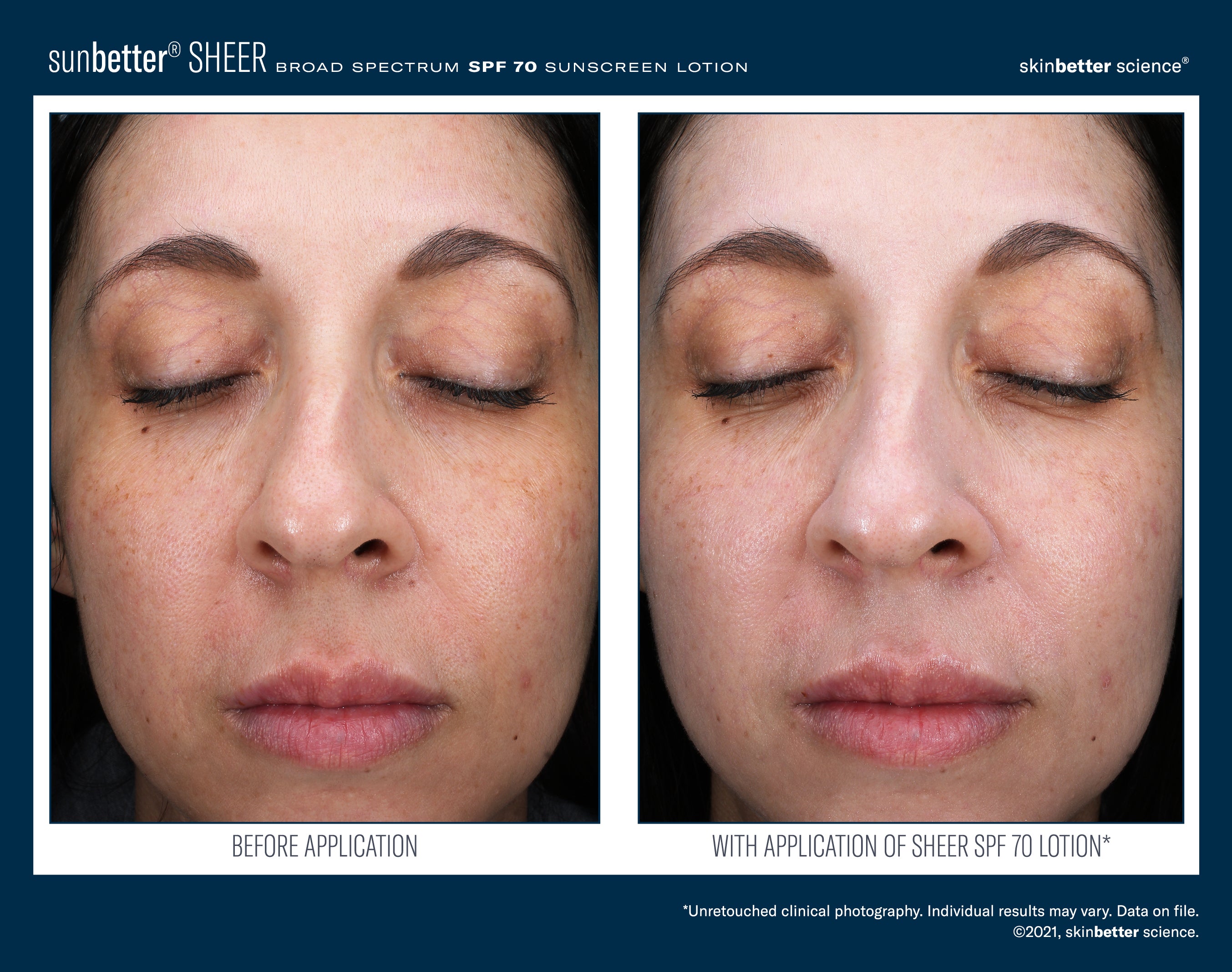 SkinBetter Science SunBetter SHEER SPF 70 Sunscreen Lotion (1.69 oz)