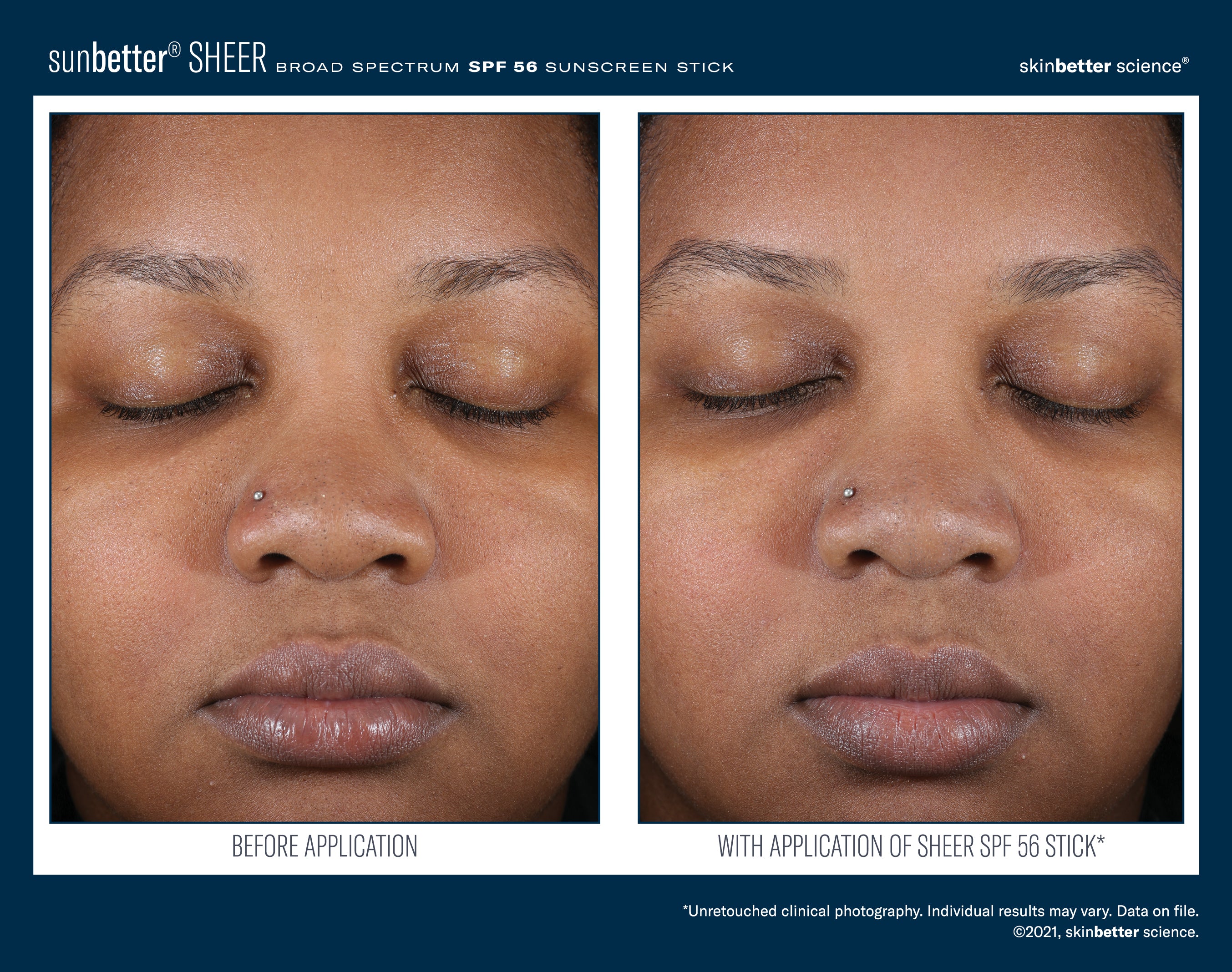 SkinBetter Science SunBetter SHEER SPF 56 Sunscreen Stick 20g