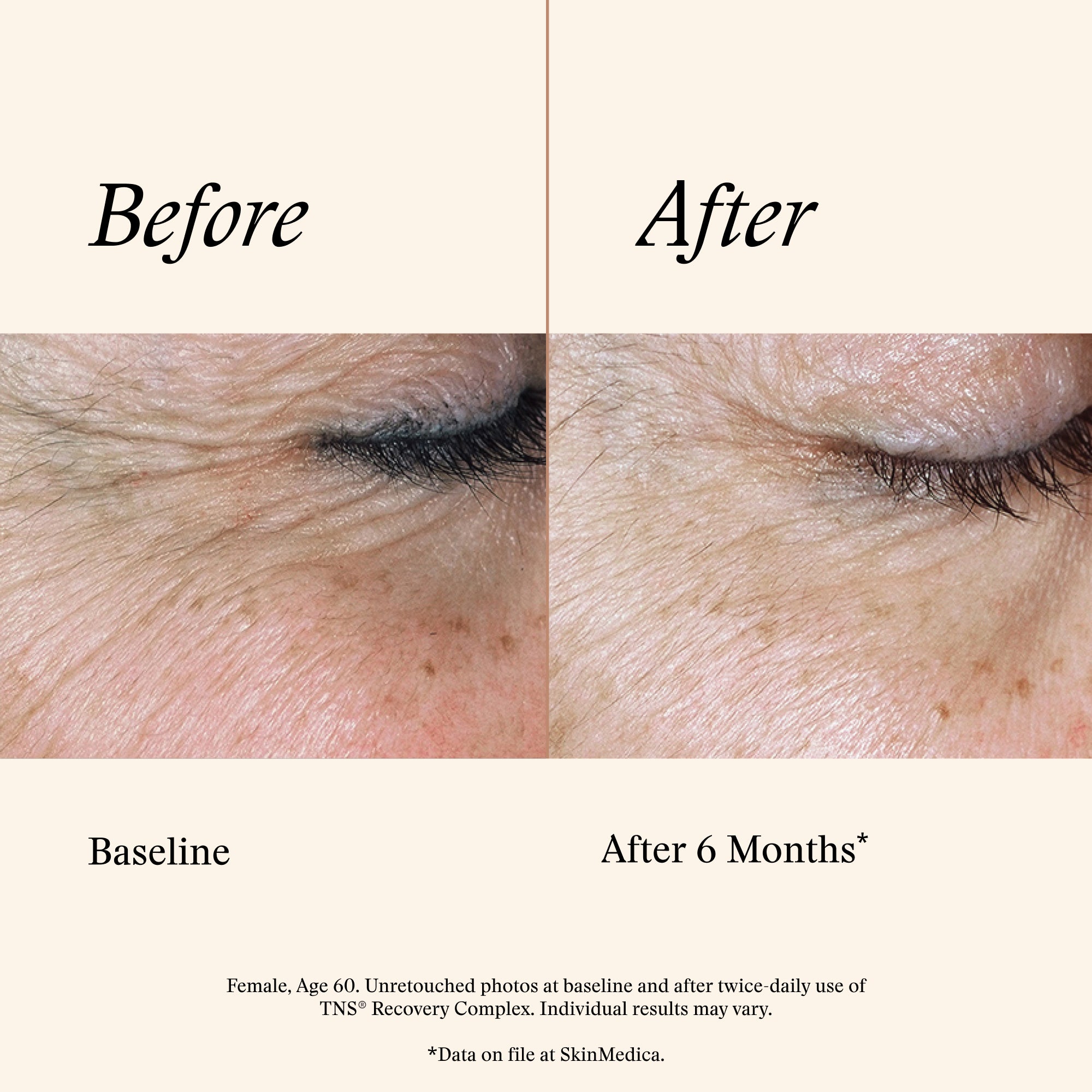 <transcy>Complejo de recuperación SkinMedica TNS (1 oz)</transcy>