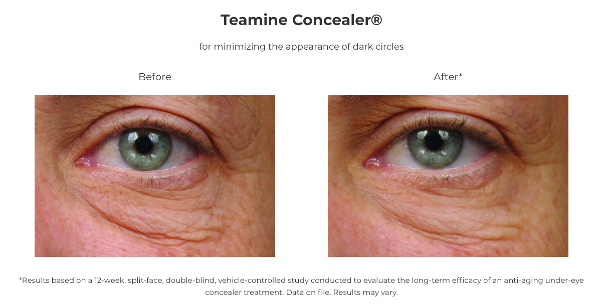 Revision Skincare Teamine® Eye Complex (0.5 oz)