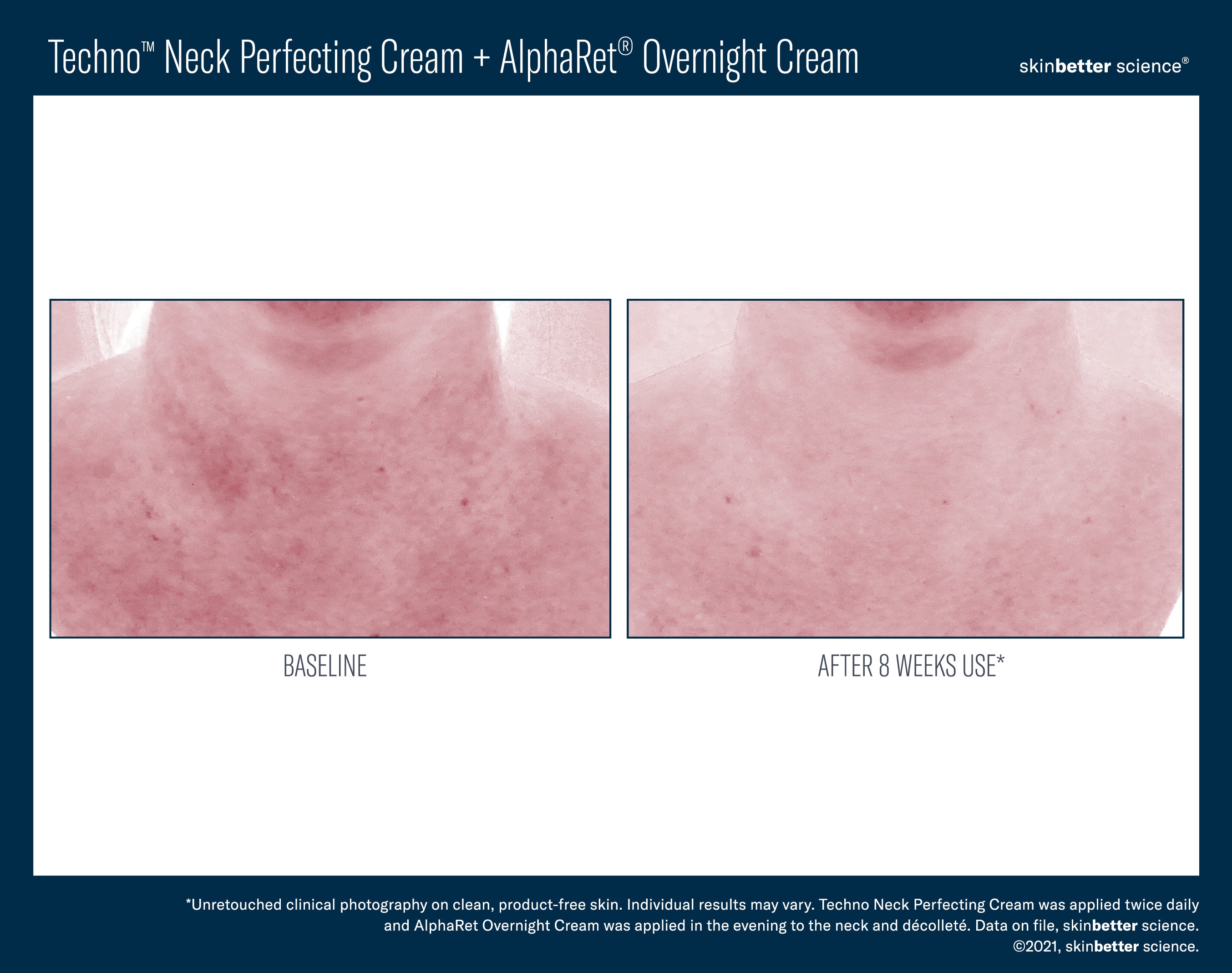 SkinBetter Science Techno Neck Perfecting Cream (1.69 oz)