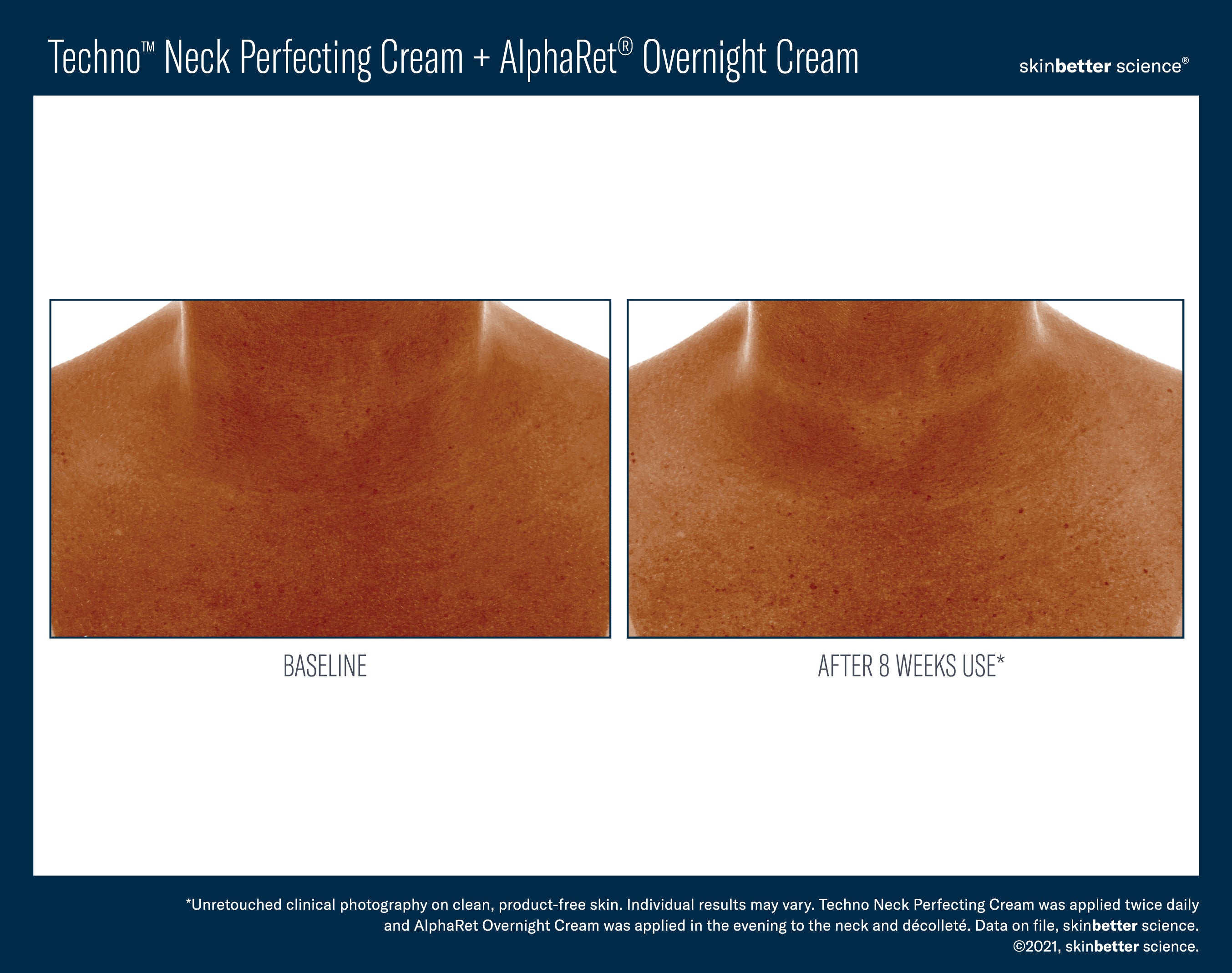 SkinBetter Science Techno Neck Perfecting Cream (1.69 oz)