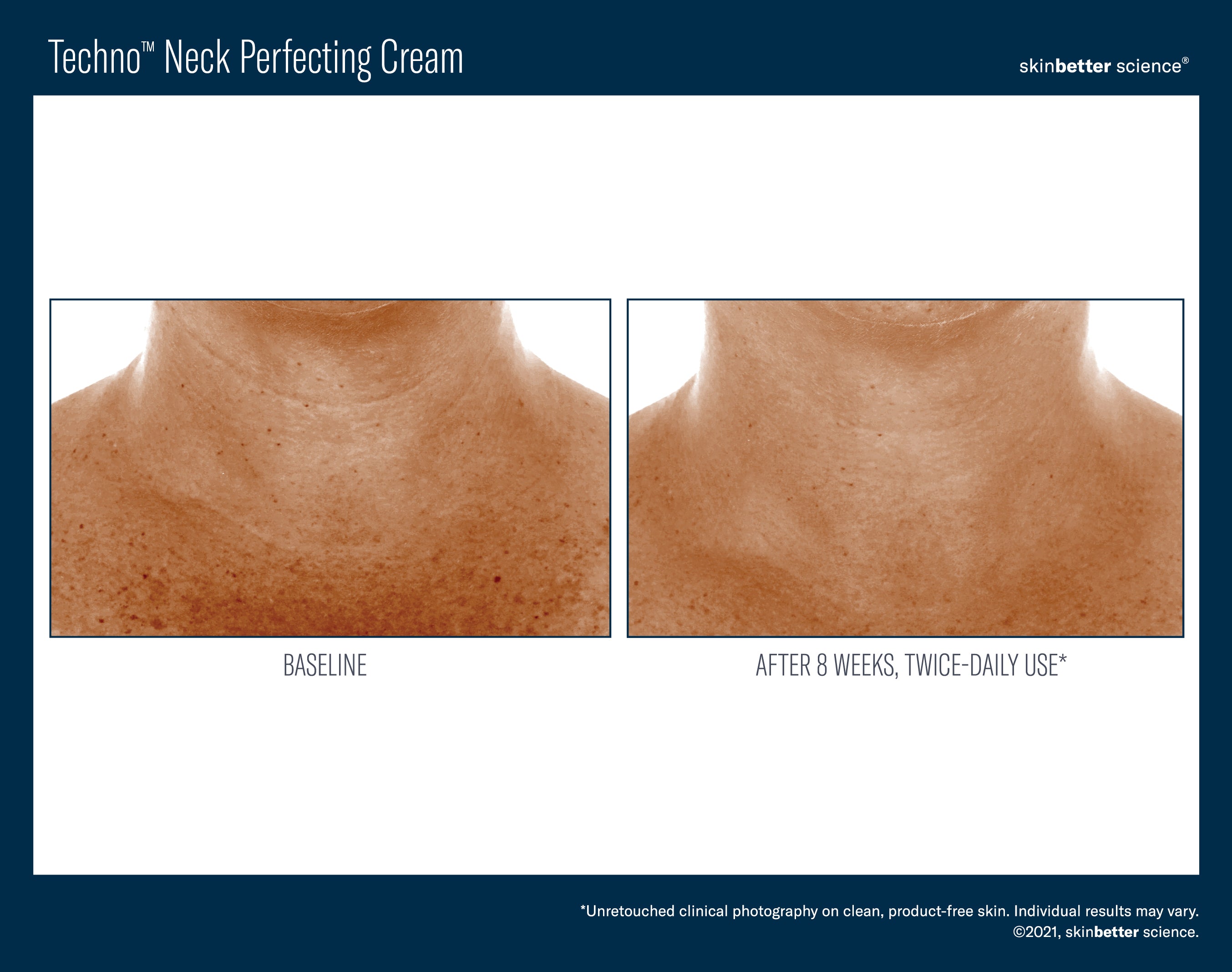 SkinBetter Science Techno Neck Perfecting Cream (1.69 oz)