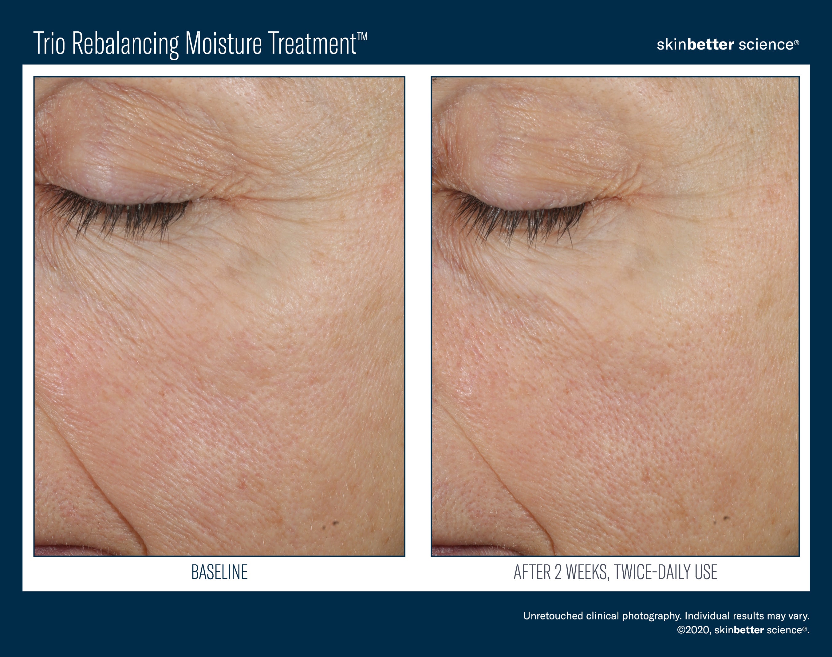 SkinBetter Science Trio Rebalancing Moisture Treatment (1.69 oz)