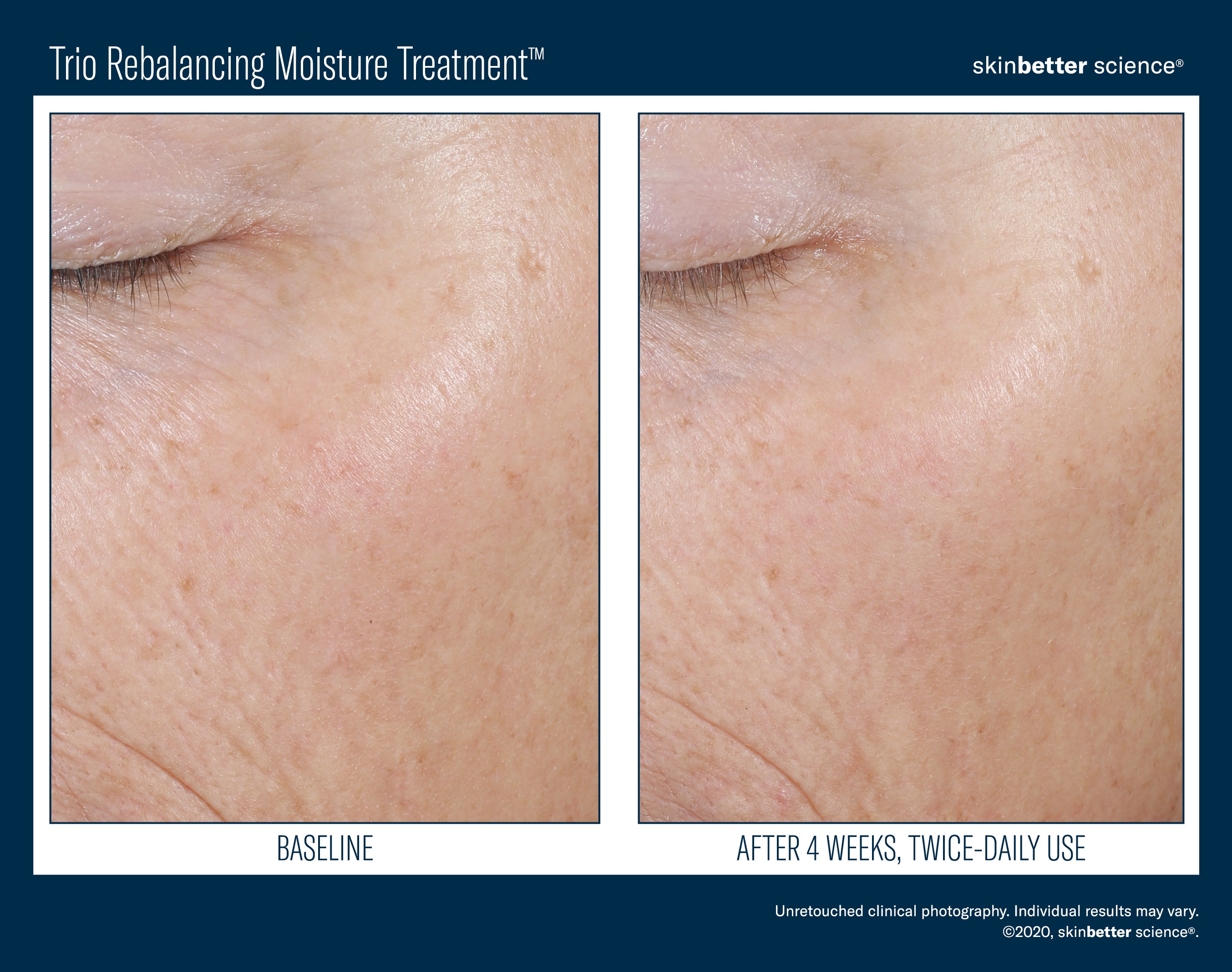 SkinBetter Science Trio Rebalancing Moisture Treatment (1.69 oz)