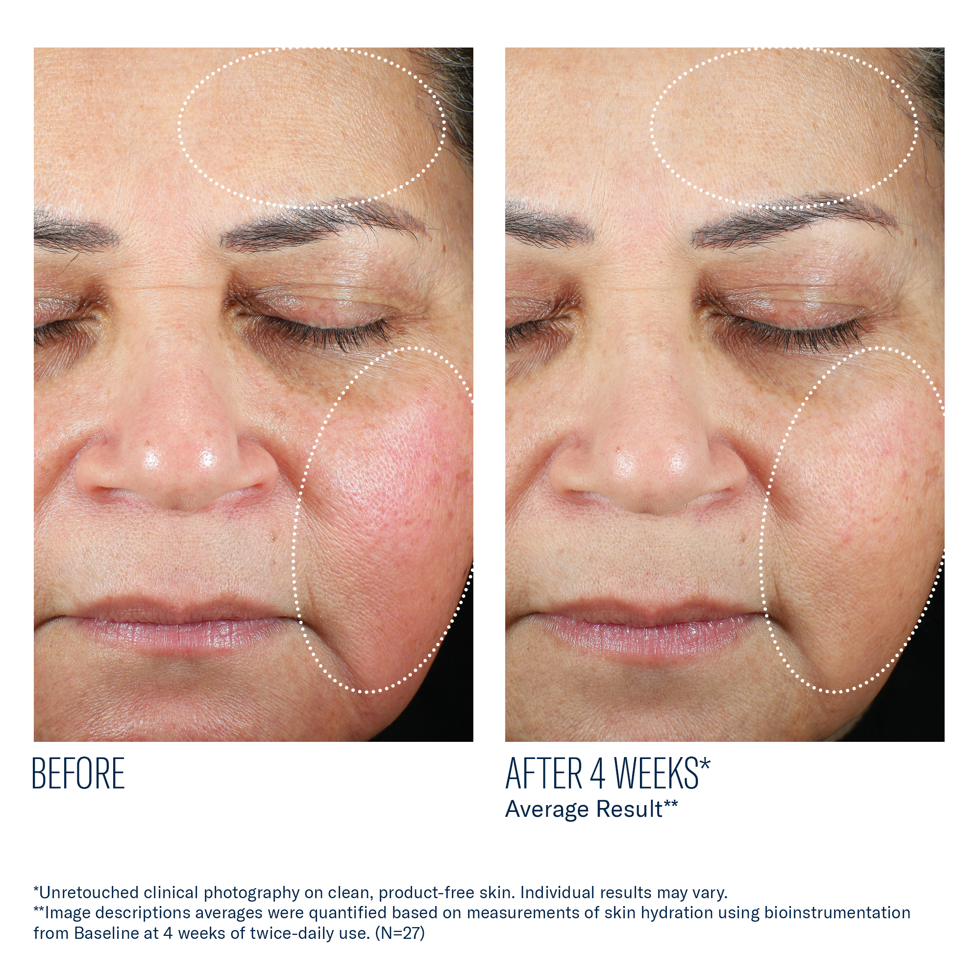 SkinBetter Science Trio Luxe Moisture Treatment (1.7 oz)