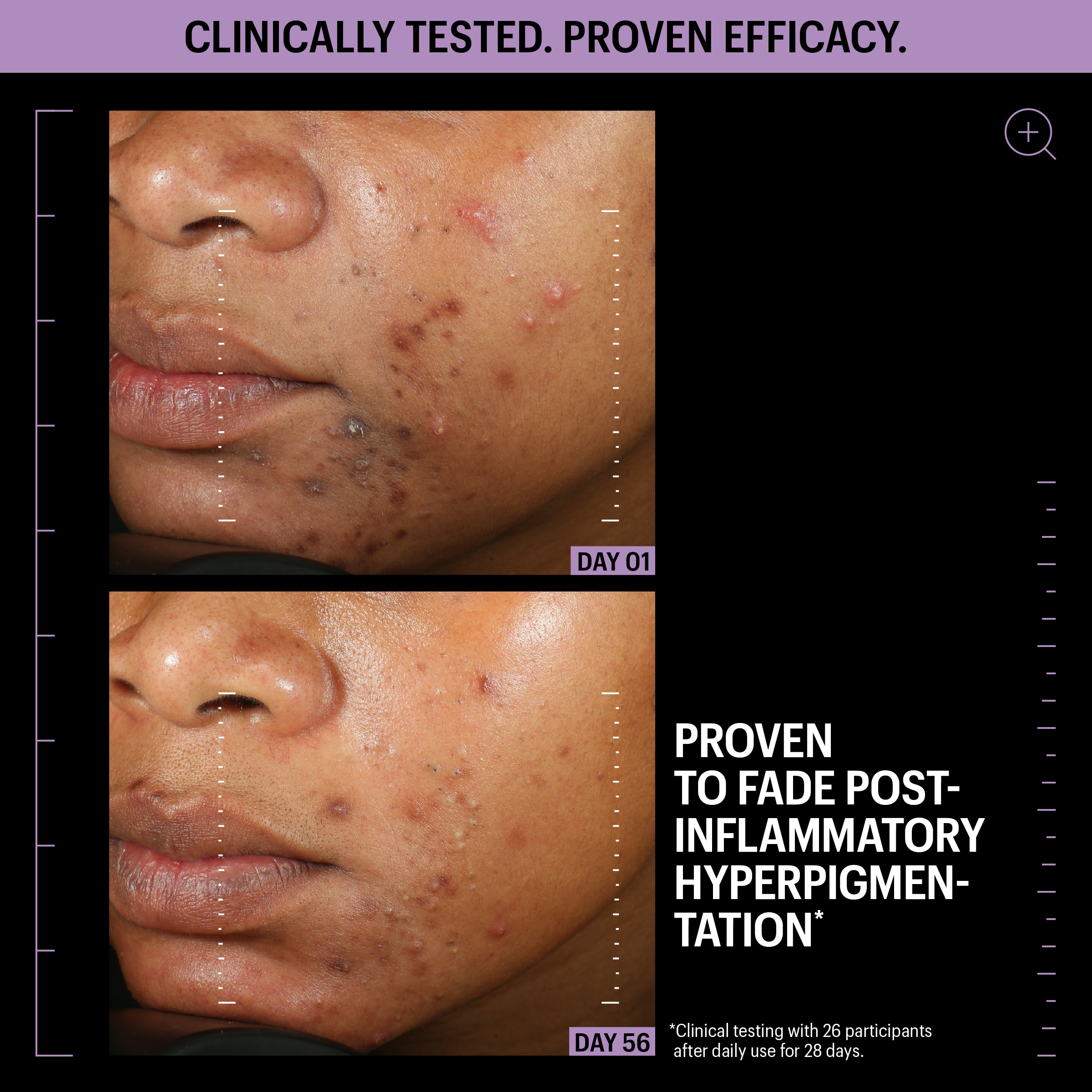 Allies of Skin Azelaic and Kojic Advanced Clarifying Serum (1 oz).