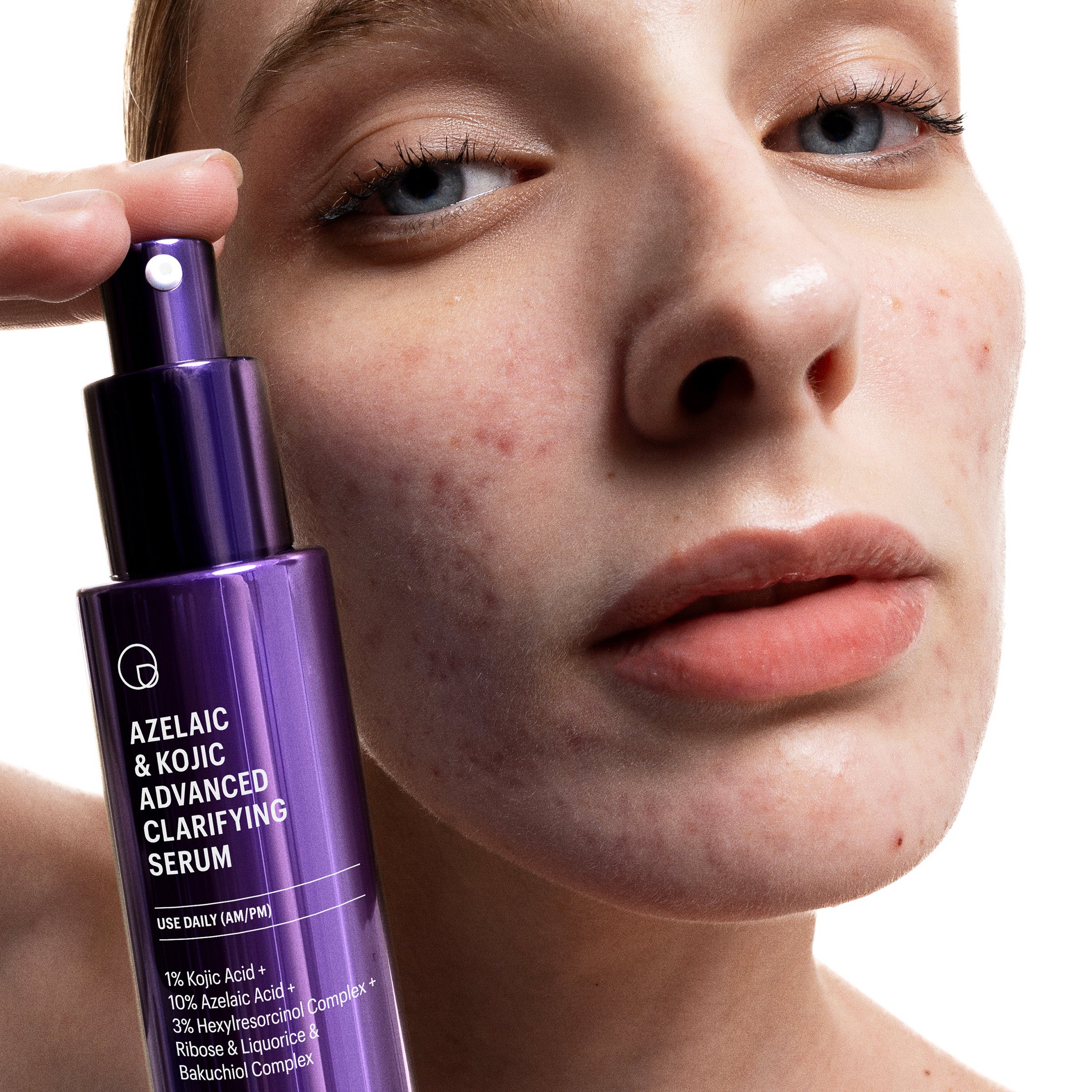 Allies of Skin Azelaic and Kojic Advanced Clarifying Serum (1 oz).