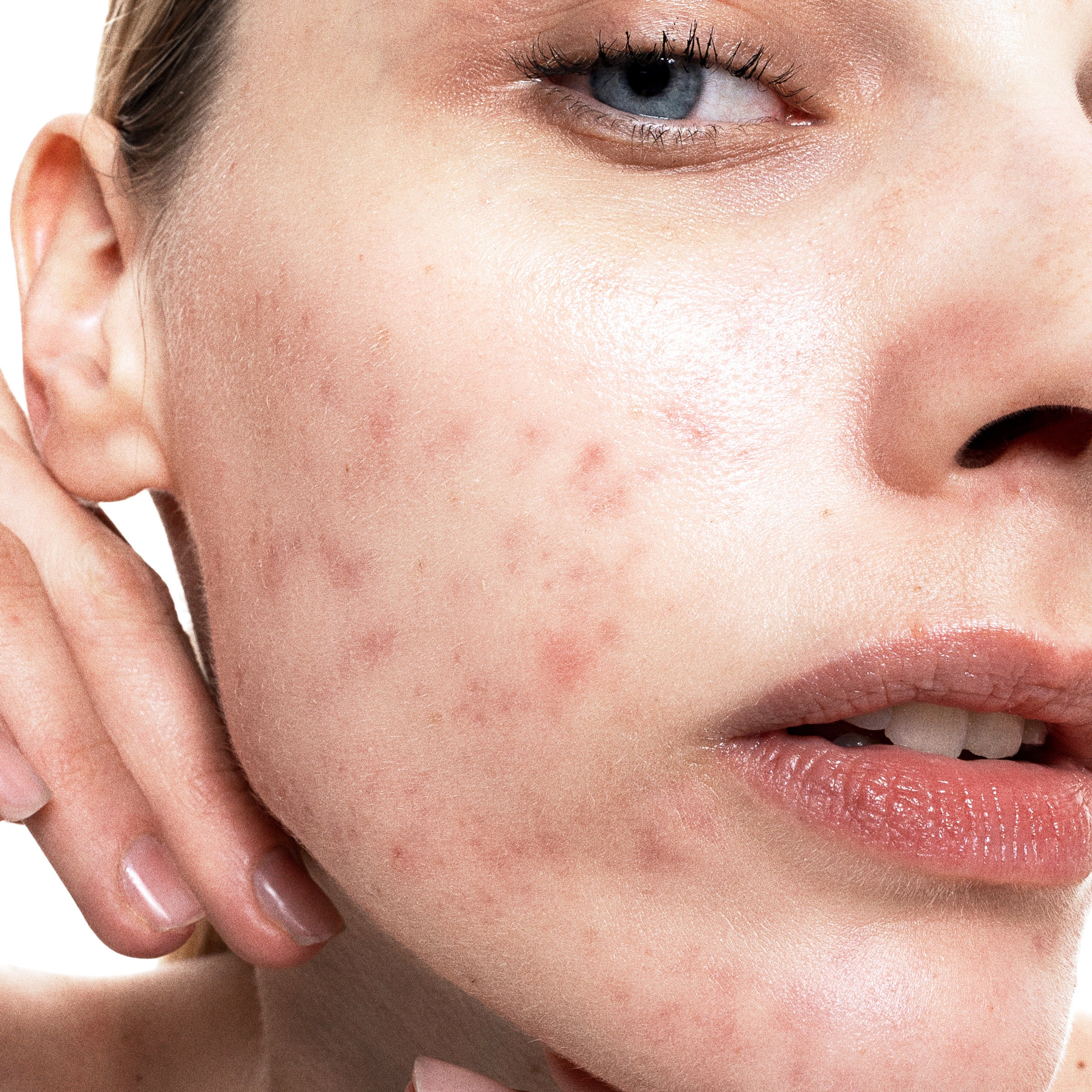 Allies of Skin Azelaic and Kojic Advanced Clarifying Serum (1 oz).