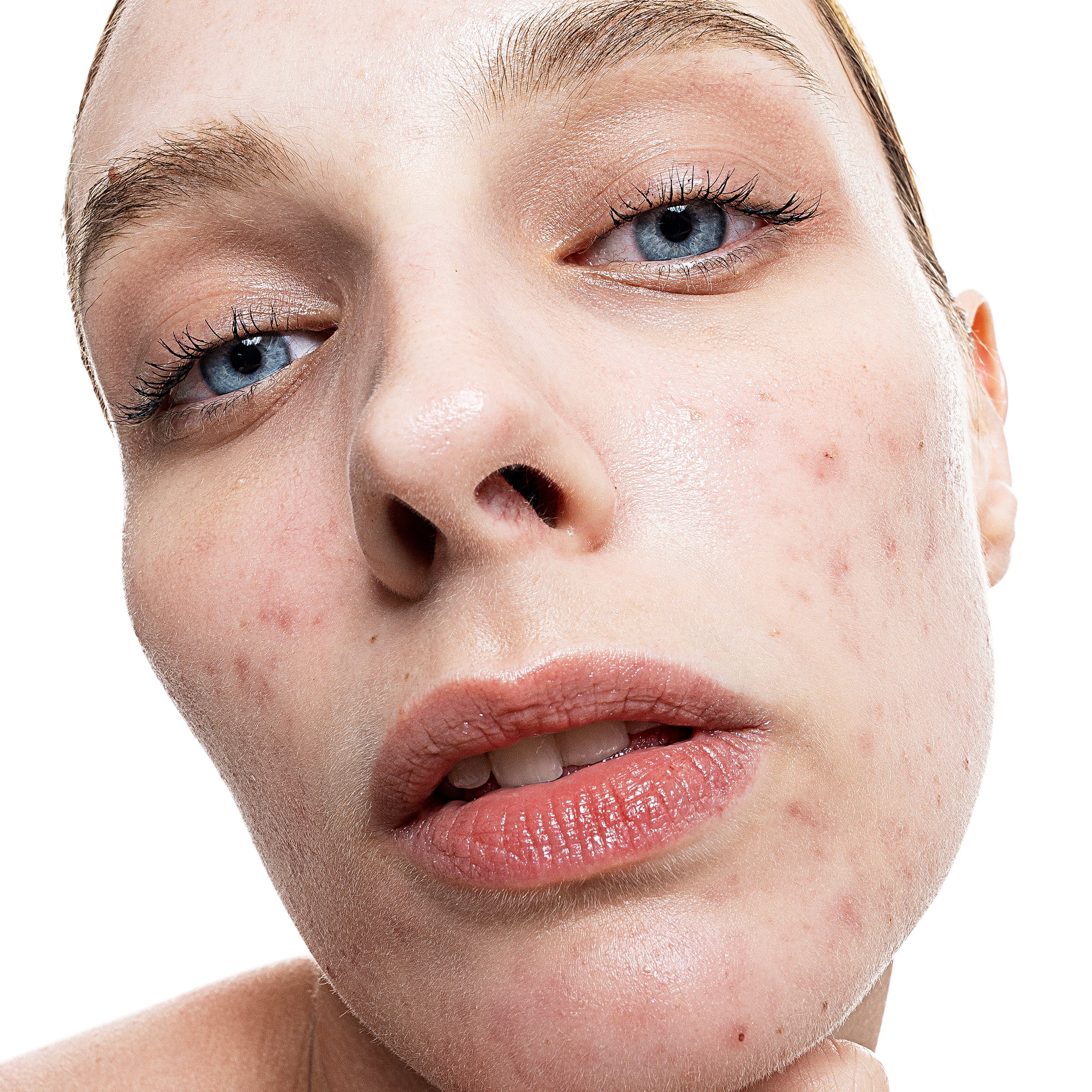 Allies of Skin Azelaic and Kojic Advanced Clarifying Serum (1 oz).