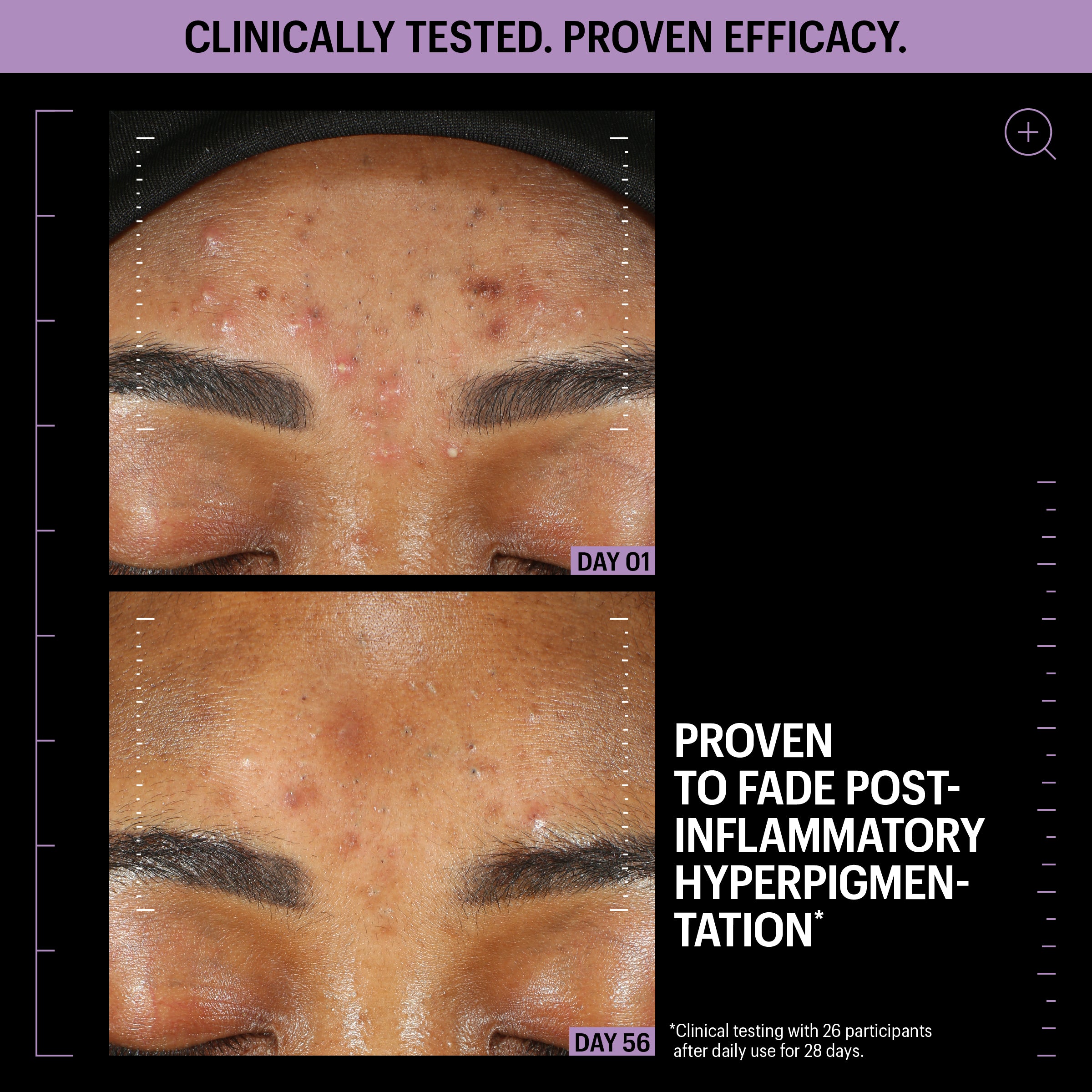 Allies of Skin Azelaic and Kojic Advanced Clarifying Serum (1 oz).