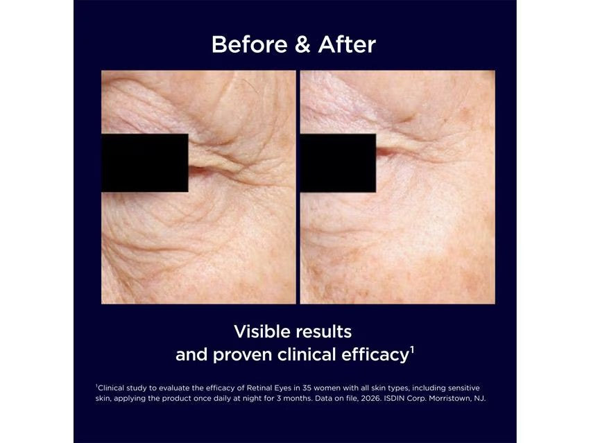 ISDIN Isdinceutics Retinal Eyes (0.67 oz)