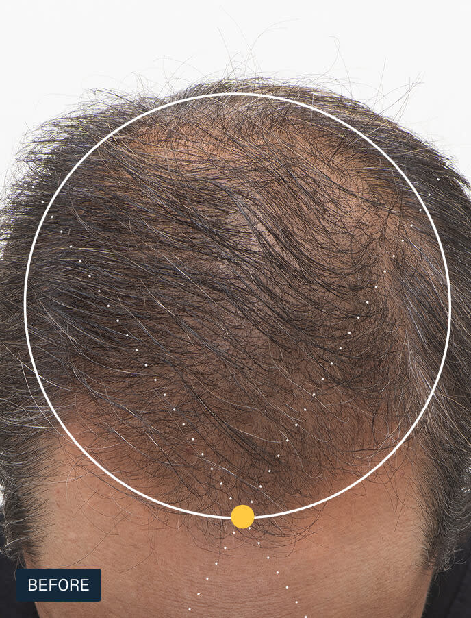 Nutrafol Men's For Men 50+ Hair Growth Nutraceutical (120 Capsules)