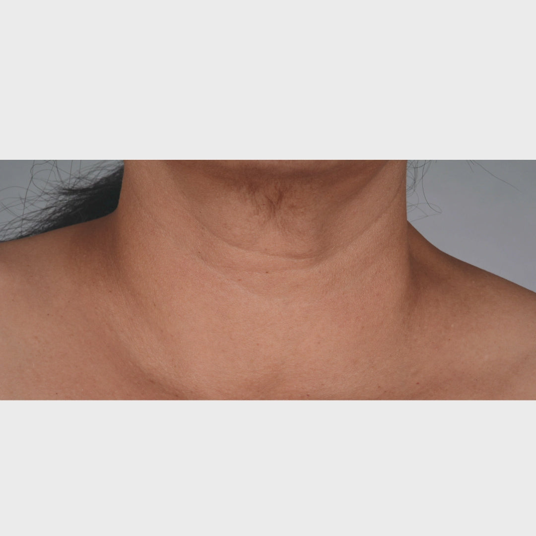 iS Clinical NeckPerfect Complex (1.7 ออนซ์)