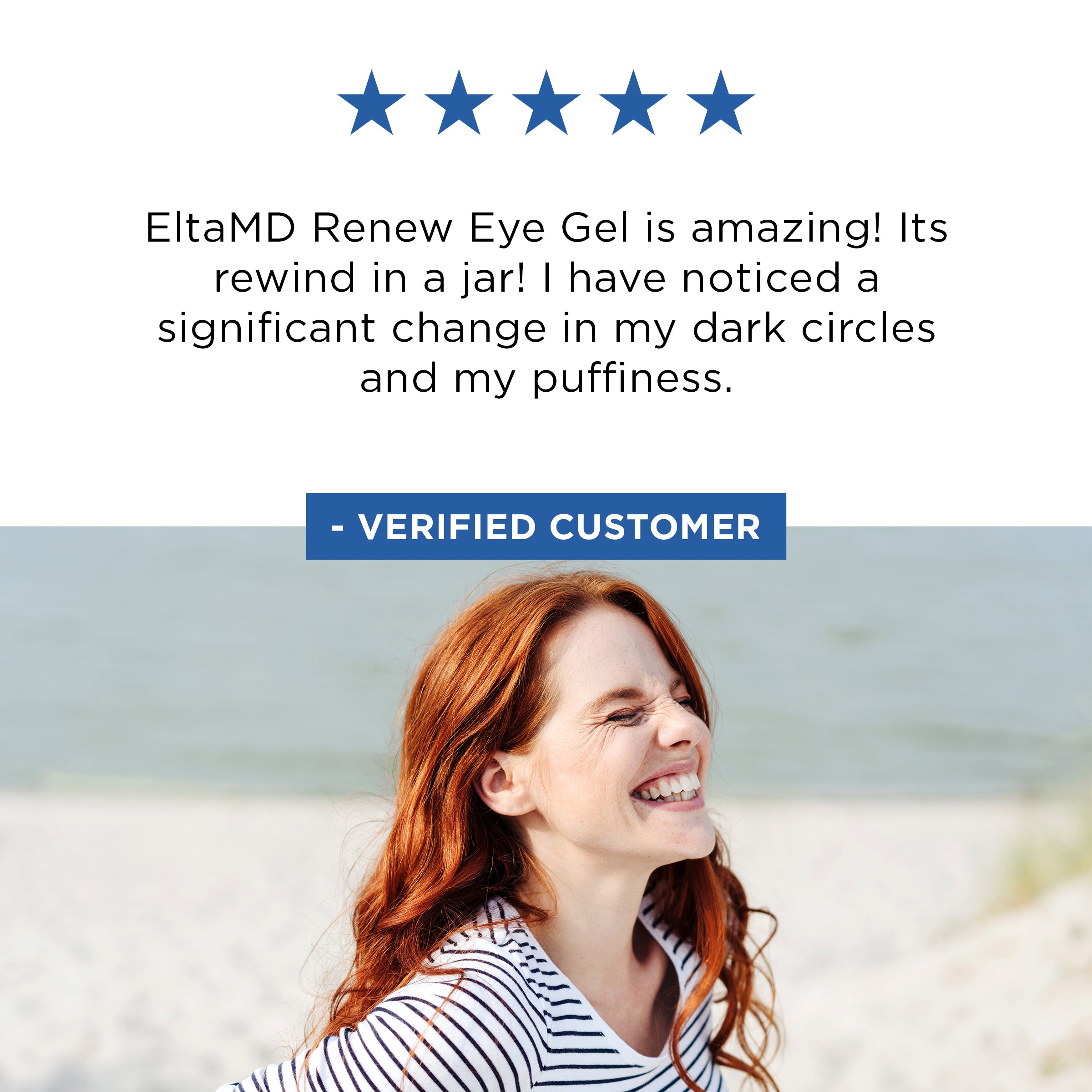 EltaMD Renew Eye Gel (0.5 унцій)