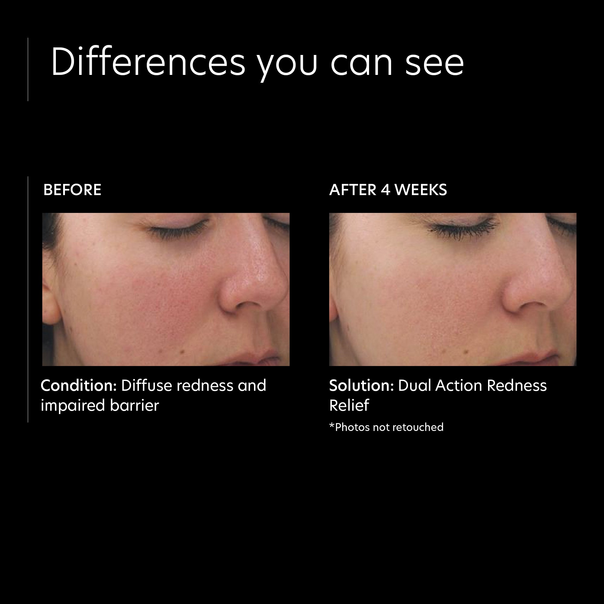 PCA Skin Dual Action Redness Relief (1 ουγκιά)