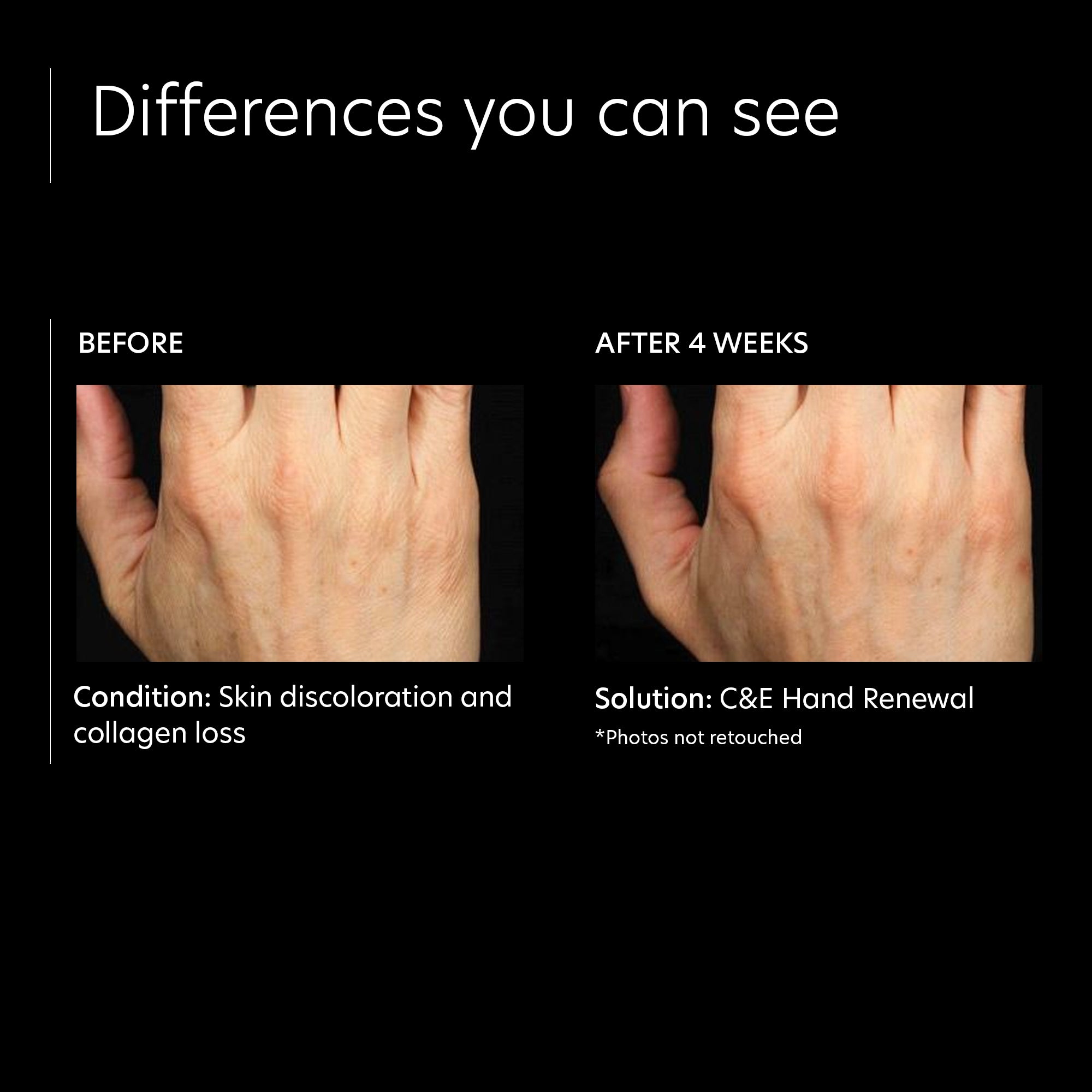 PCA Skin C&E Hand Renewal (1 أونصة)