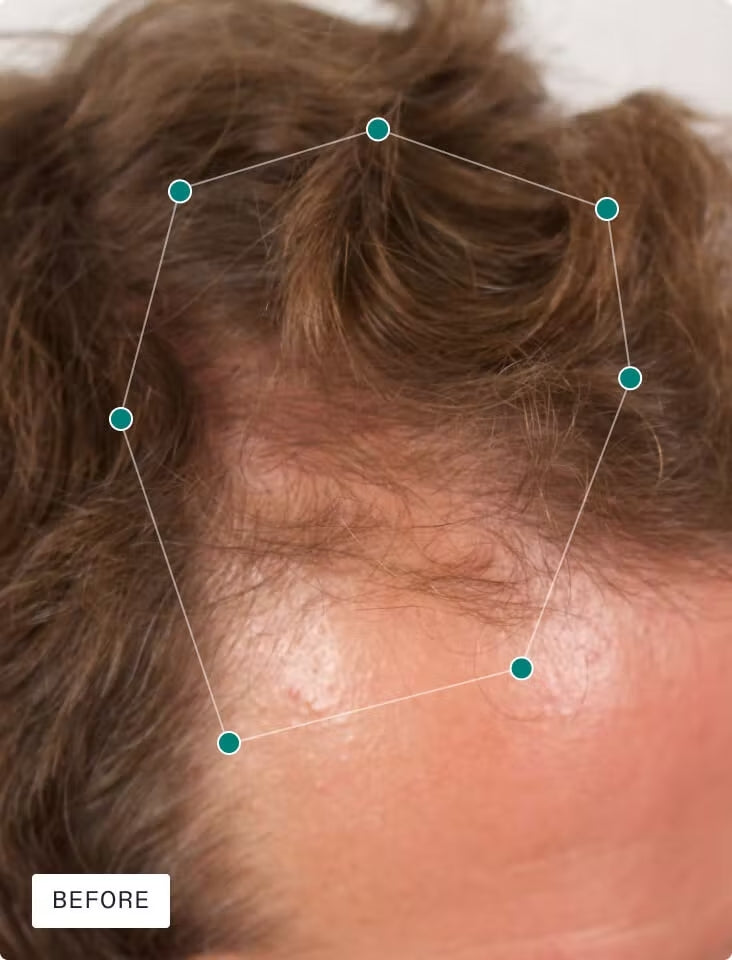 Nutrafol Men's Hair Growth Nutraceutical (120 պարկուճ)