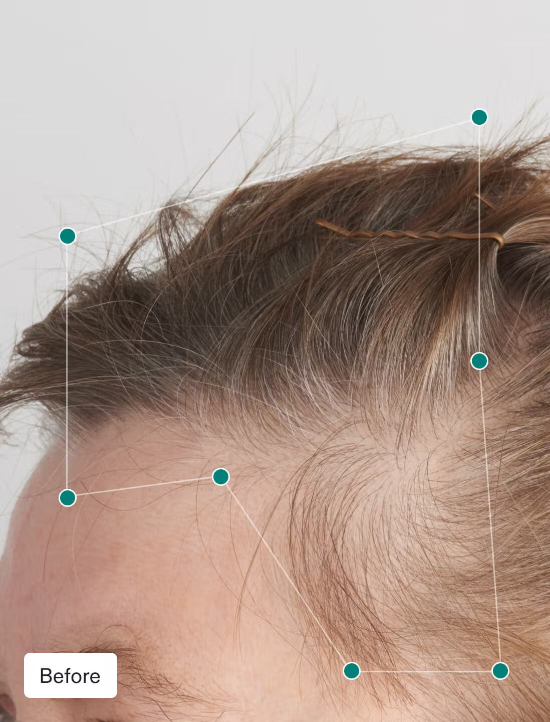 Nutrafol Дамски баланс за растеж на косата