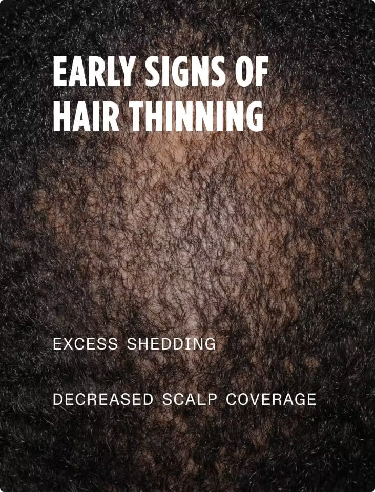 Nutrafol vyrų plaukų augimo paketas