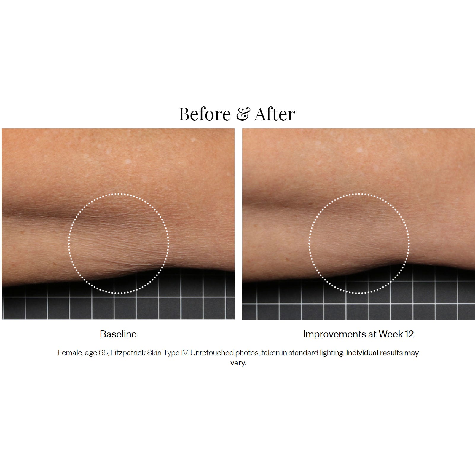 SkinMedica Firm & Tone Body Lotion før og etter resultater