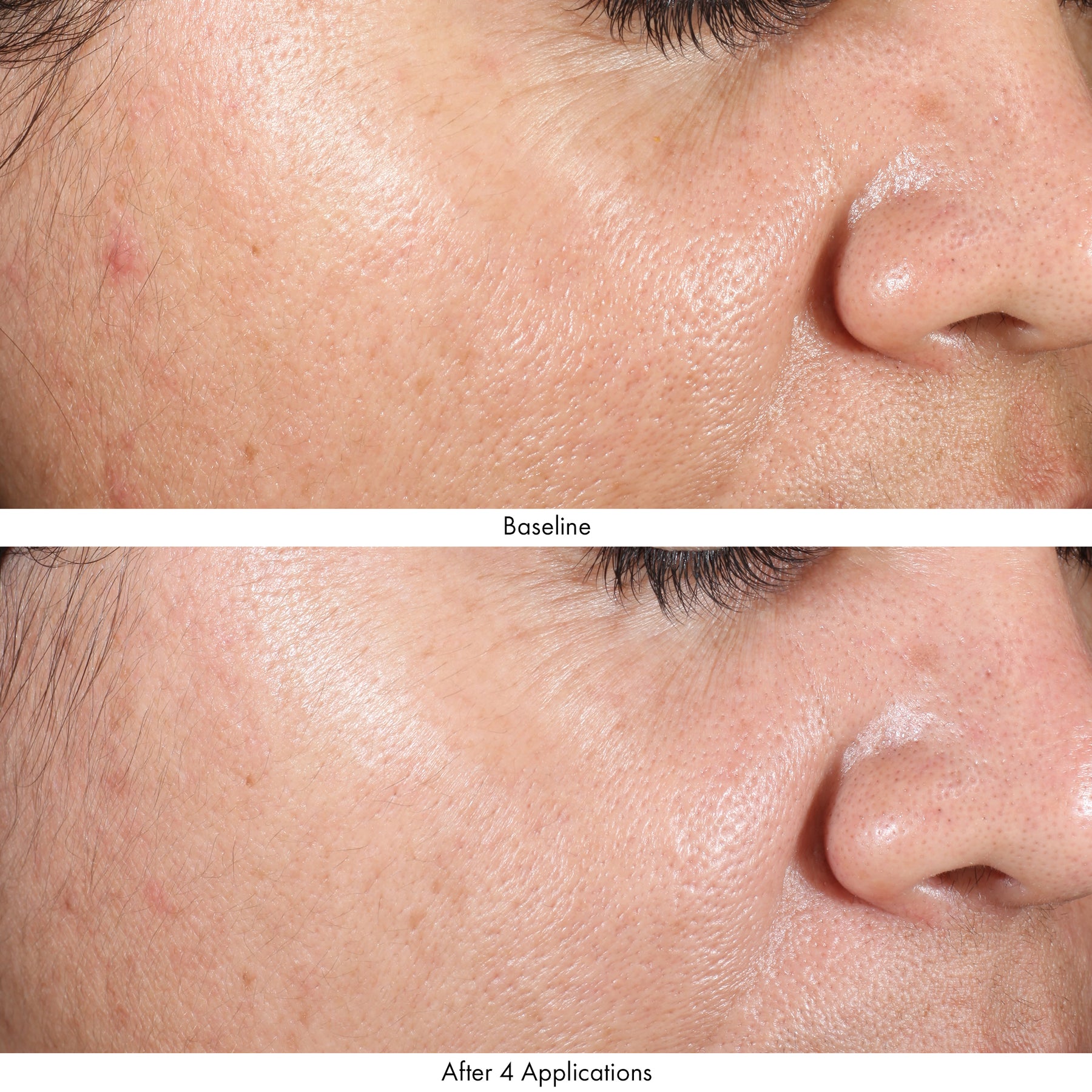 Obagi Revivify MultiAcid Facial Peel