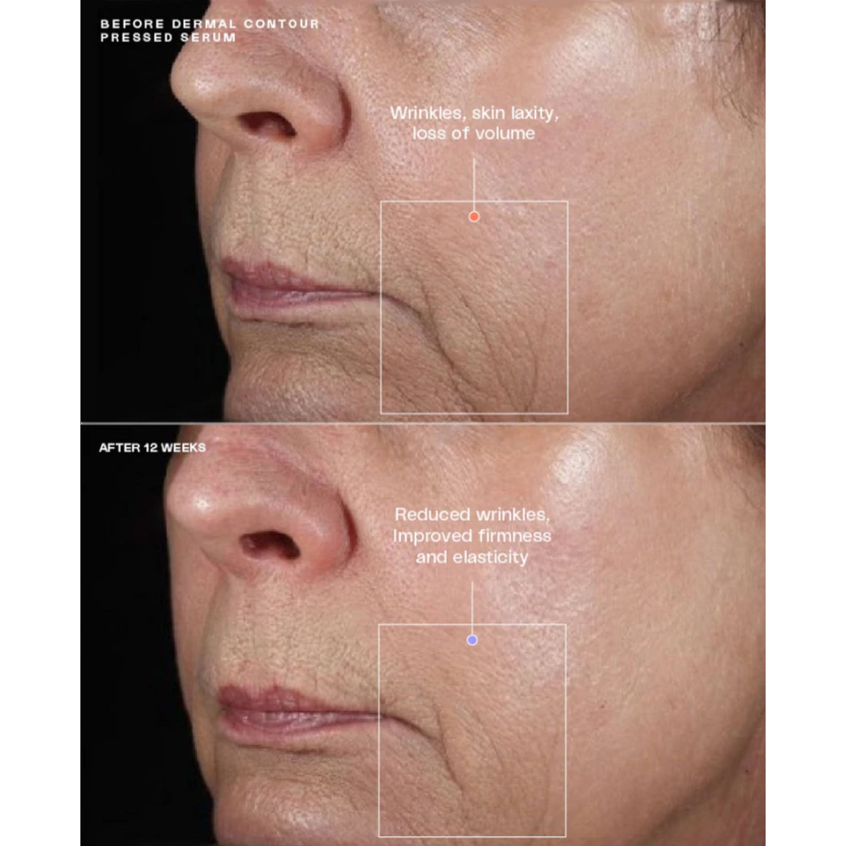 Sente Dermal Contour Pressed Serum | 79% of subjects showed improvement in skin firmness at 12 weeks