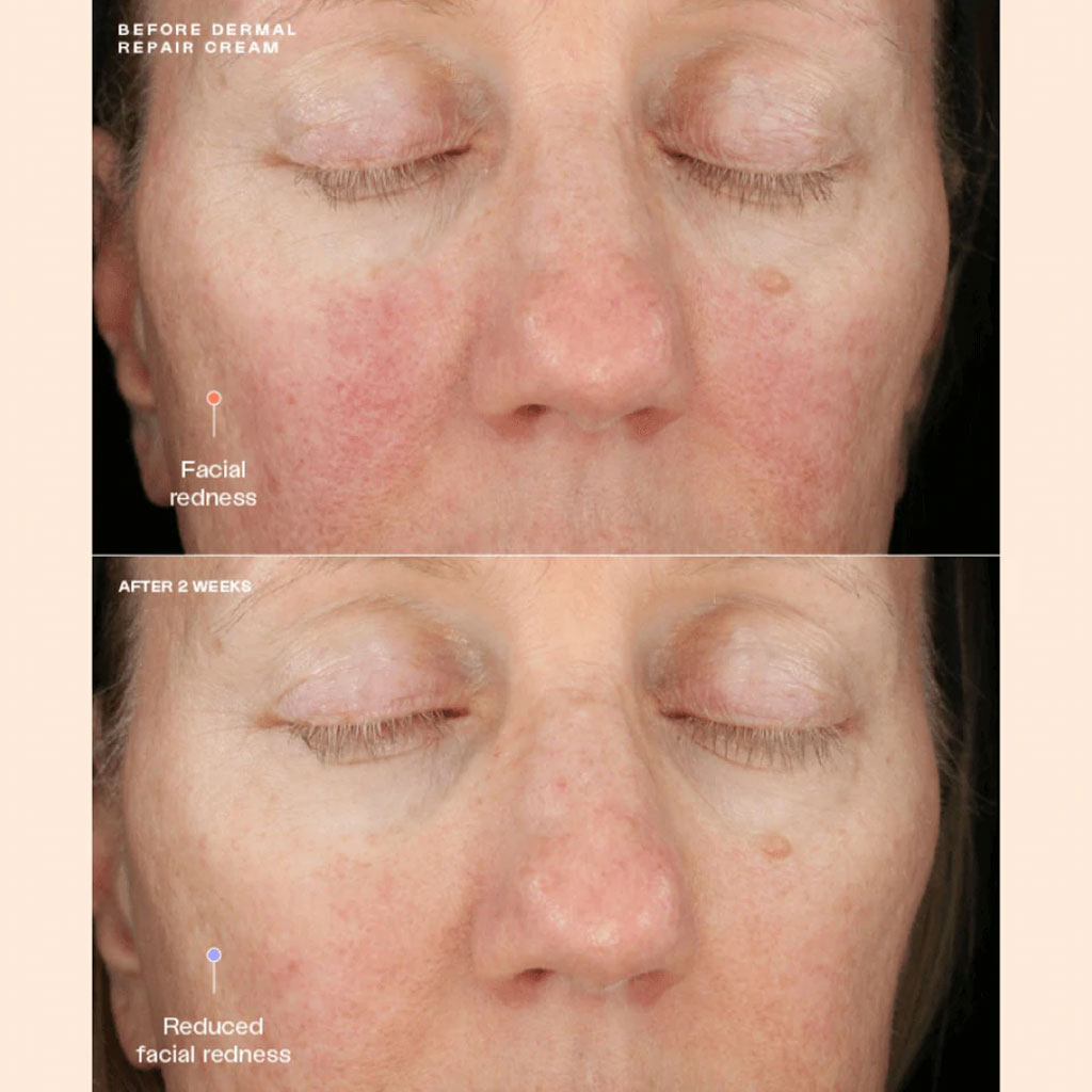 Sente Dermal Repair Cream з HSA