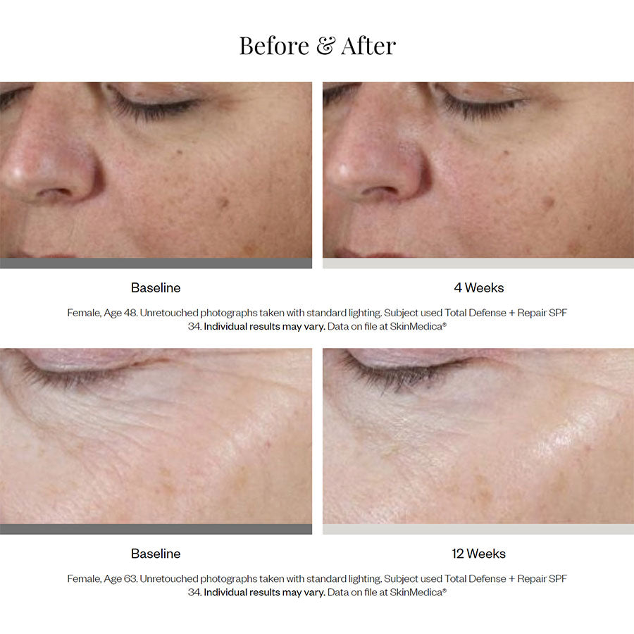 SkinMedica Total Defense + Repair Broad Spectrum SPF 34 / PA++++ Sólarvörn fyrir og eftir